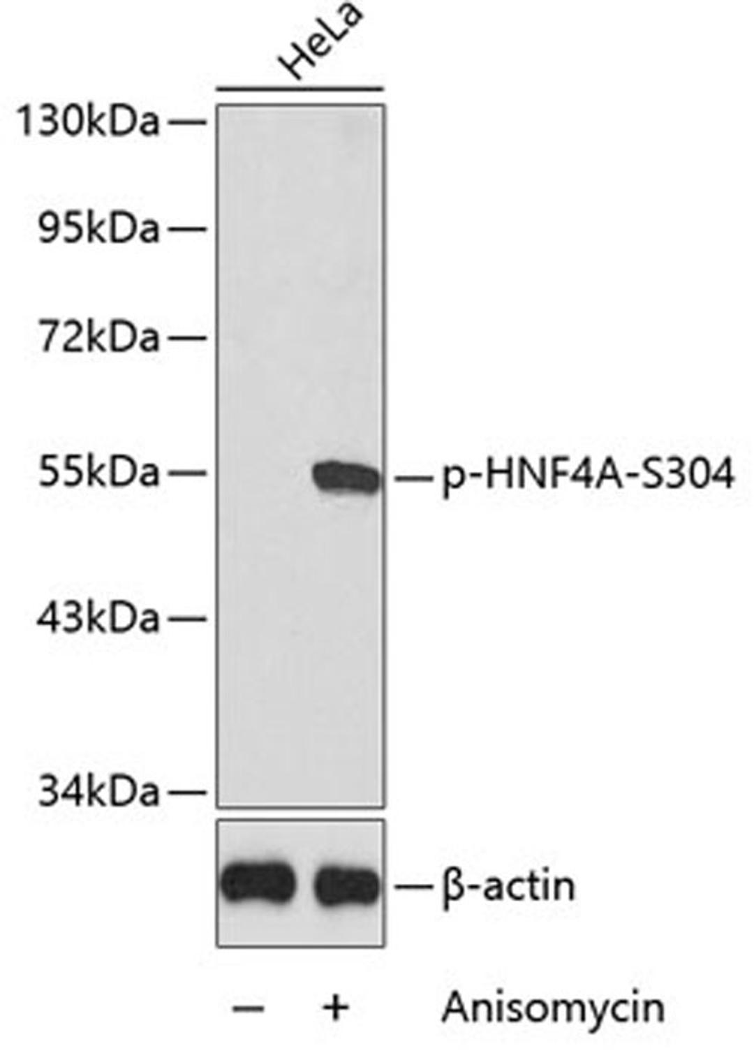 Western blot - Phospho-HNF4A-S304 antibody (AP0362)