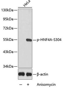 Western blot - Phospho-HNF4A-S304 antibody (AP0362)