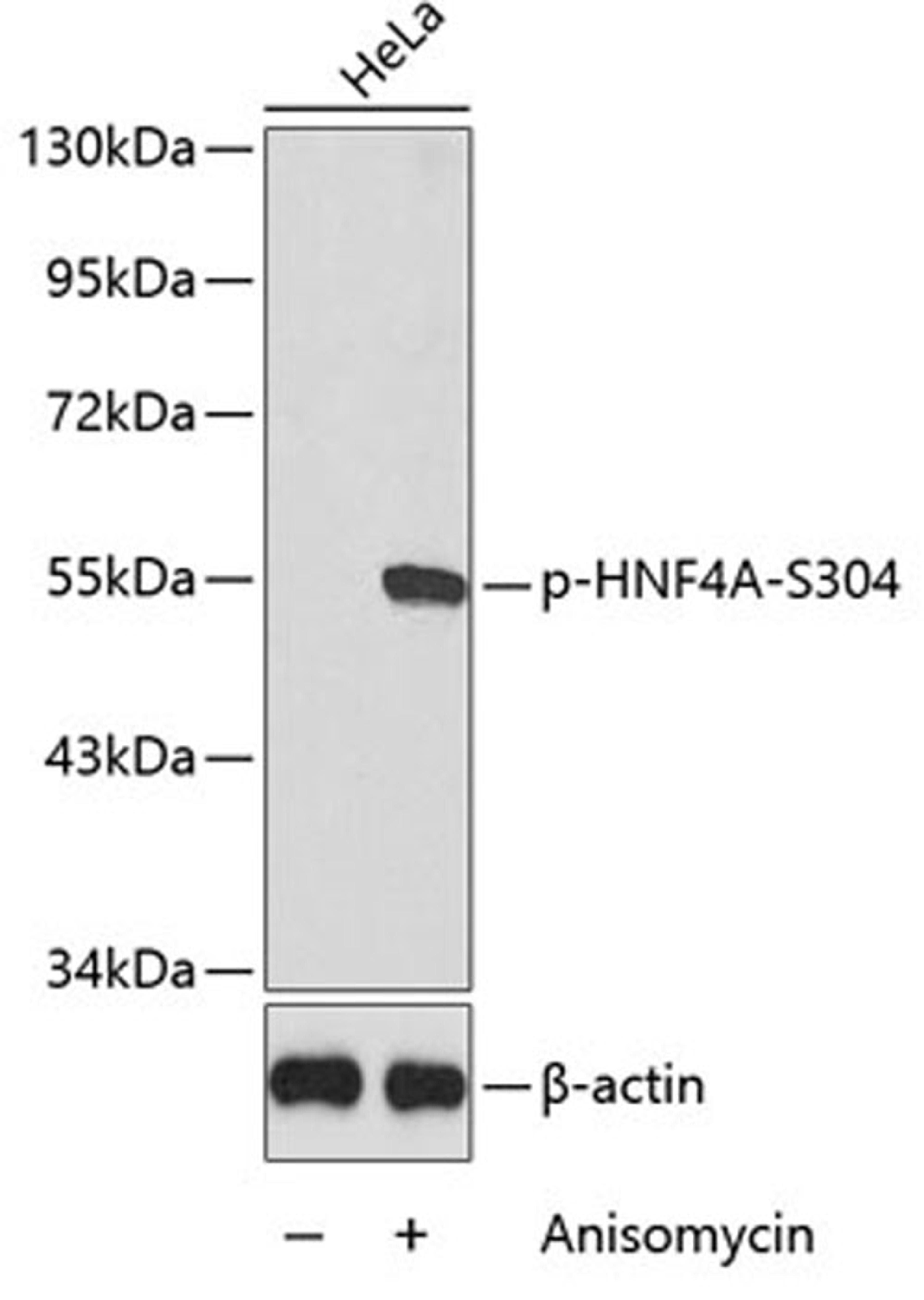 Western blot - Phospho-HNF4A-S304 antibody (AP0362)