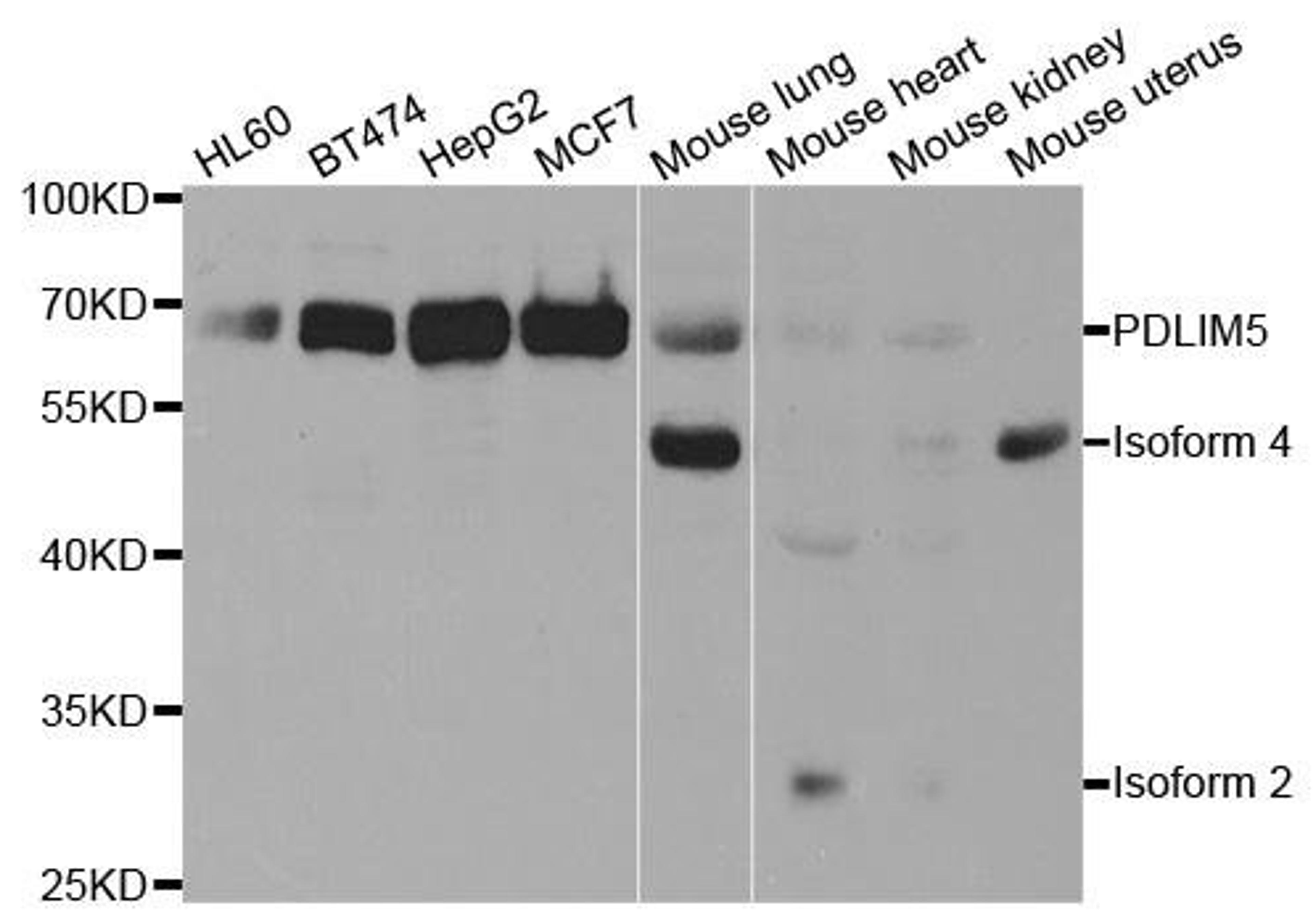 Western blot analysis of extracts of various cell lines using PDLIM5 antibody