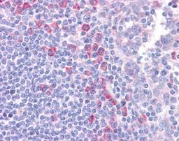 Immunohistochemistry-Paraffin: DLL1 Antibody [NBP1-59217] - Human Tonsil Tissue, 4-8ug/ml.