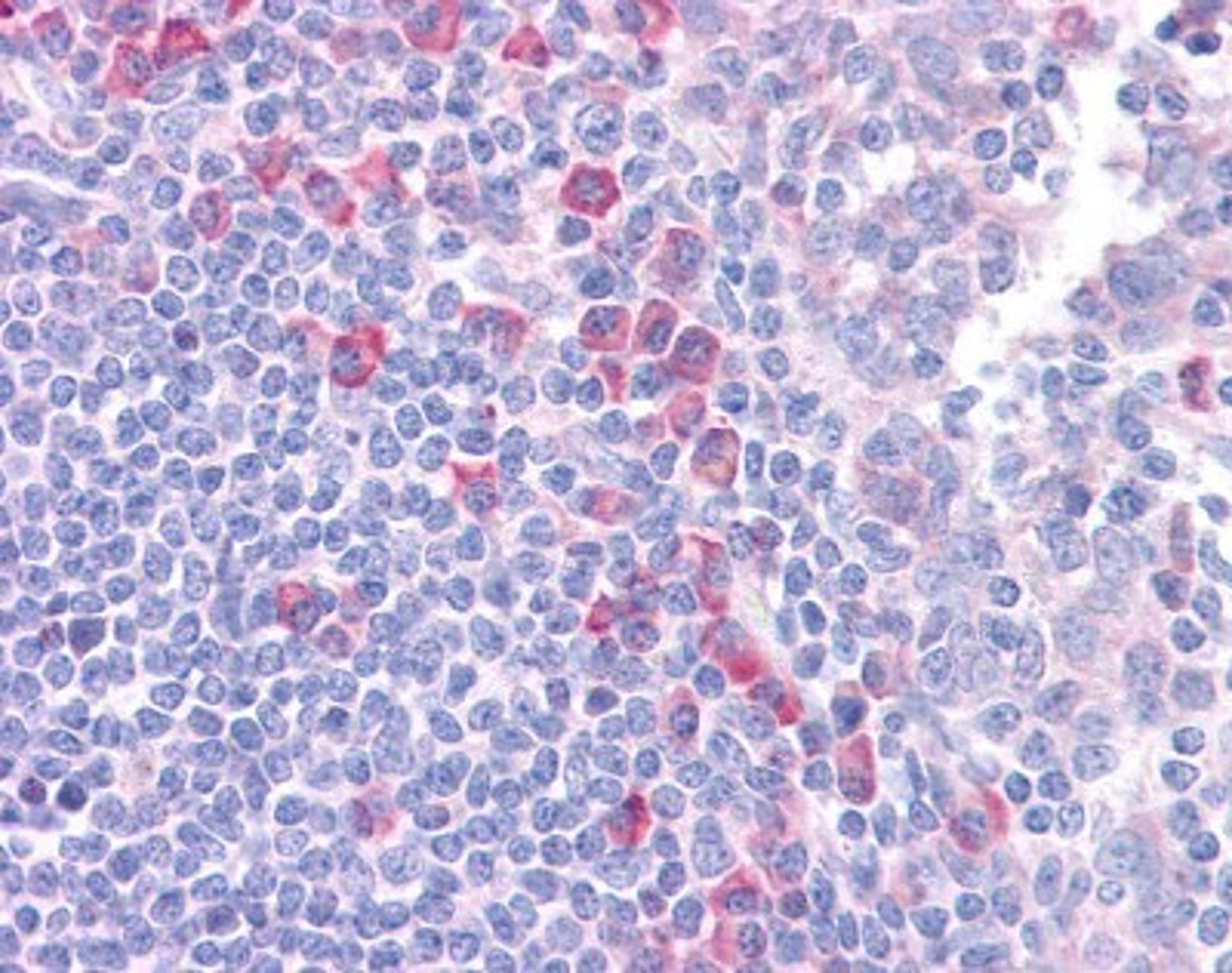 Immunohistochemistry-Paraffin: DLL1 Antibody [NBP1-59217] - Human Tonsil Tissue, 4-8ug/ml.