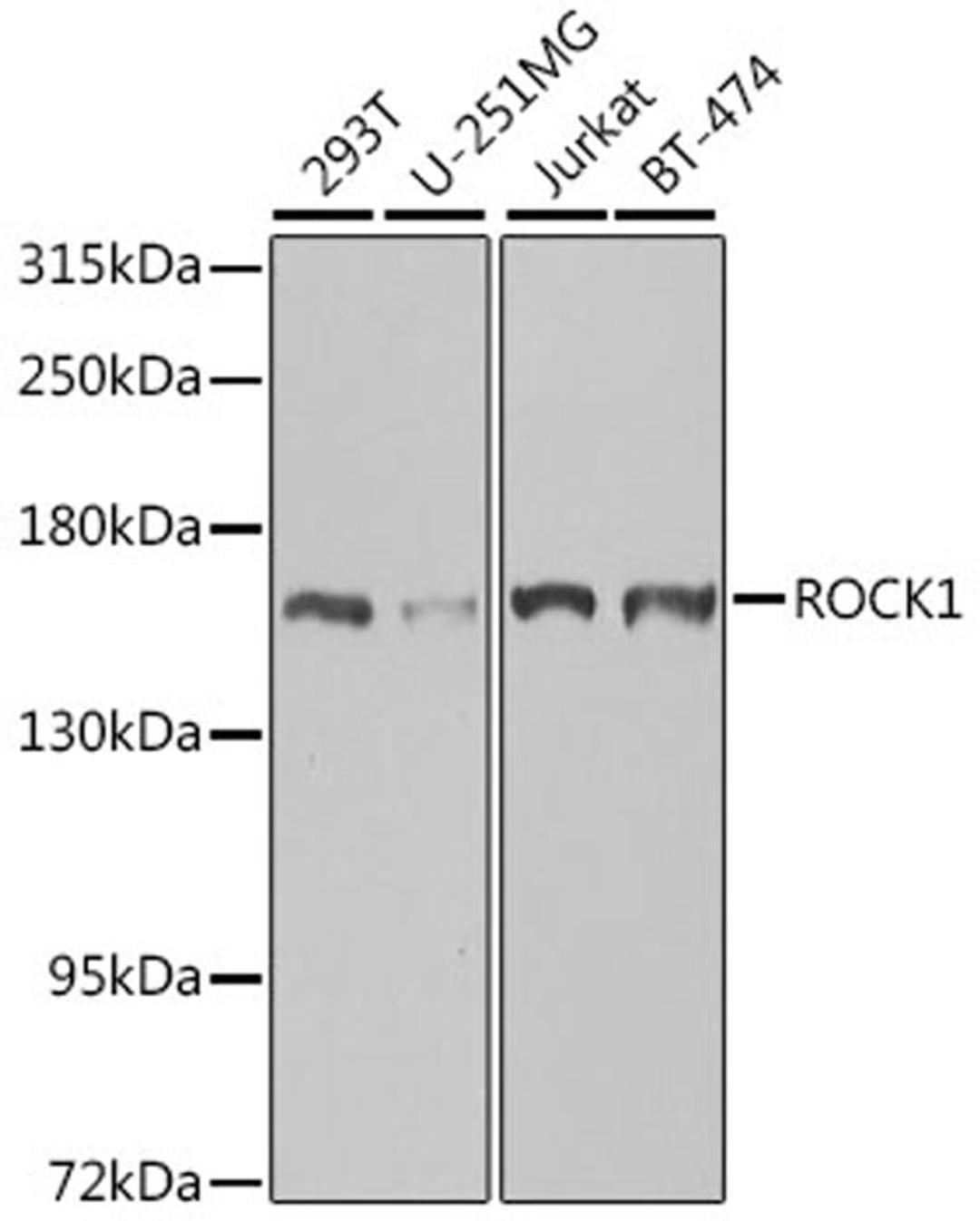 Western blot - ROCK1 antibody (A1008)