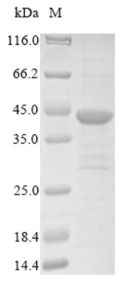 (Tris-Glycine gel) Discontinuous SDS-PAGE (reduced) with 5% enrichment gel and 15% separation gel.