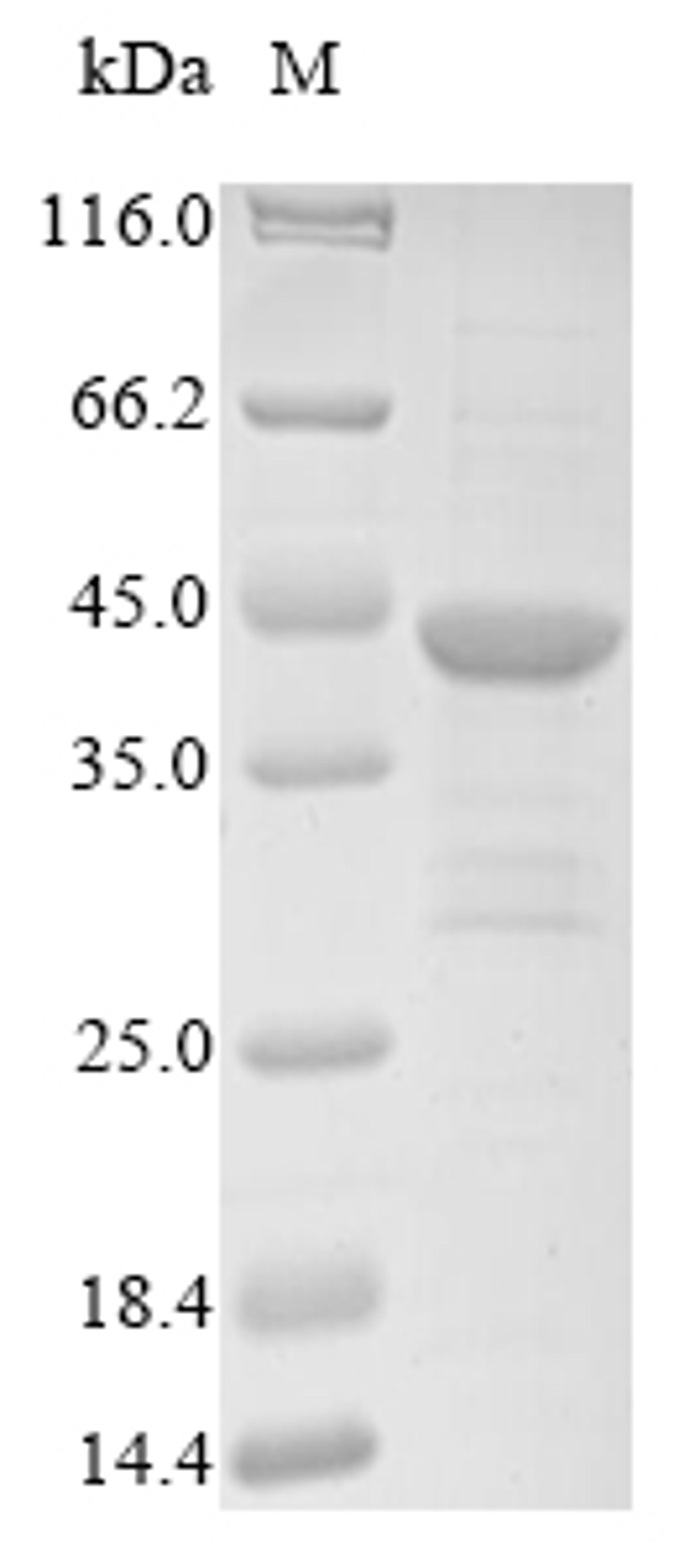 (Tris-Glycine gel) Discontinuous SDS-PAGE (reduced) with 5% enrichment gel and 15% separation gel.