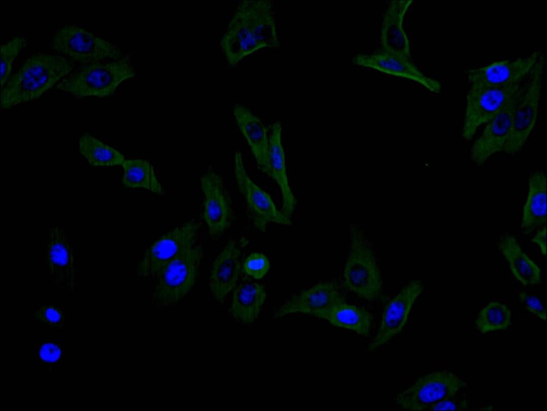 Immunofluorescence staining of HEPG2 cell with CSB-RA001827MA1HU at 1:100,  counter-stained with DAPI. The cells were fixed in 4% formaldehyde and blocked in 10% normal Goat Serum. The cells were then incubated with the antibody overnight at 4C. The secondary antibody was FITC-conjugated AffiniPure Goat Anti-Mouse IgG(H+L).