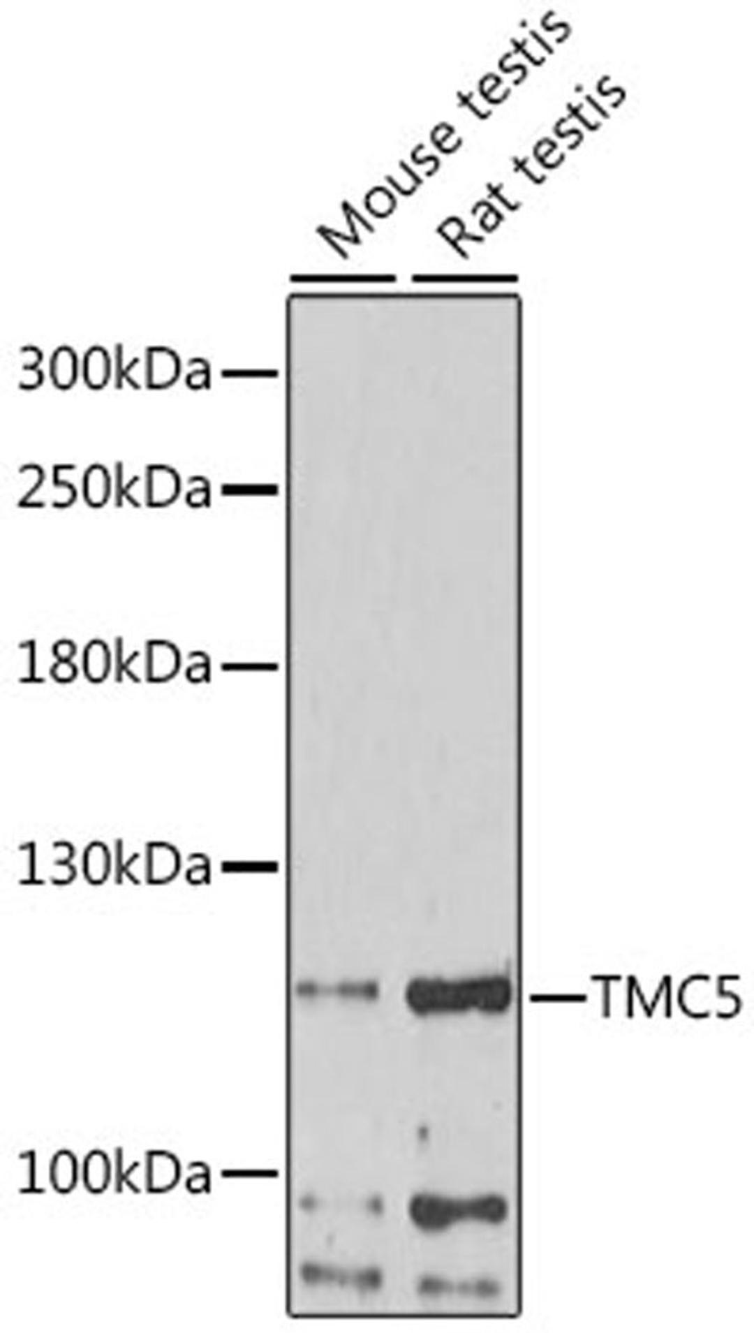 Western blot - TMC5 antibody (A16145)