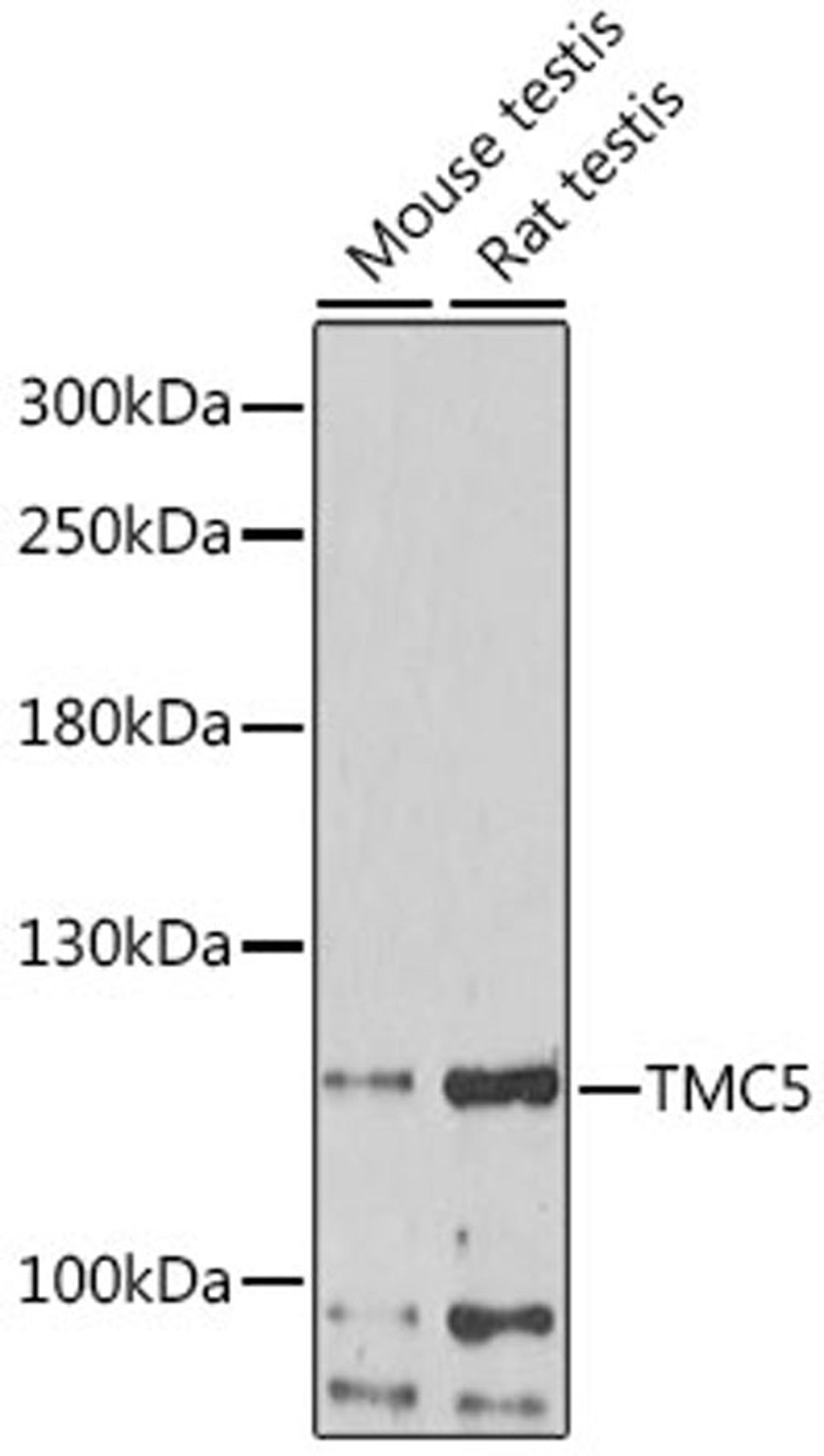 Western blot - TMC5 antibody (A16145)