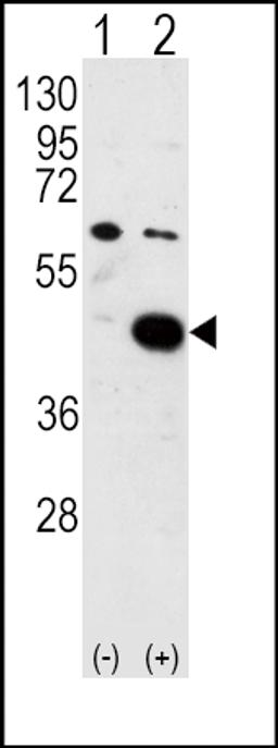 Western blot analysis of PDK2 using PDK2 Antibody using 293 cell lysates (2 ug/lane) either nontransfected (Lane 1) or transiently transfected with the PDK2 gene (Lane 2).