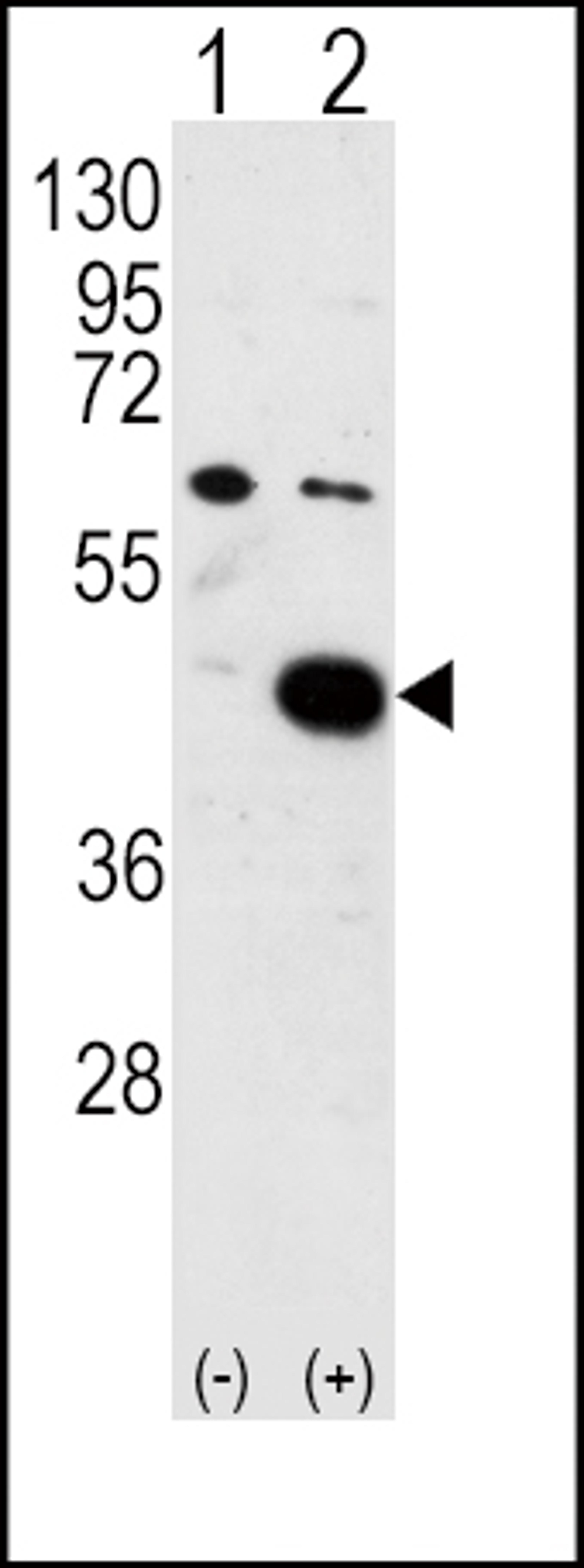 Western blot analysis of PDK2 using PDK2 Antibody using 293 cell lysates (2 ug/lane) either nontransfected (Lane 1) or transiently transfected with the PDK2 gene (Lane 2).