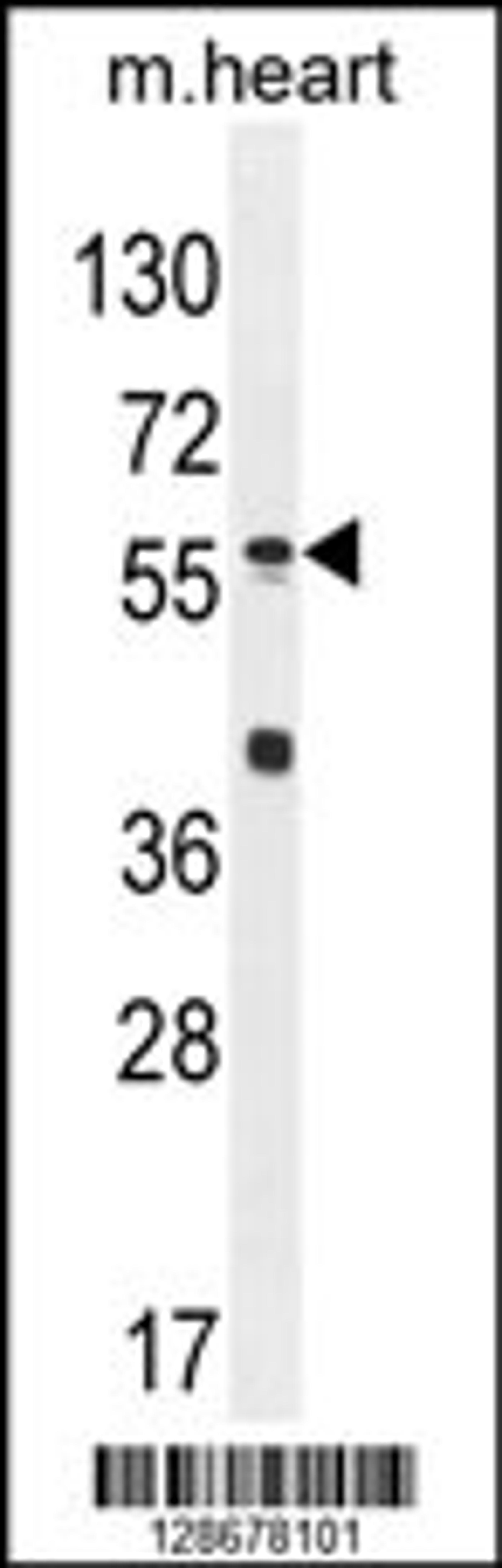 Western blot analysis in mouse heart tissue lysates (35ug/lane).