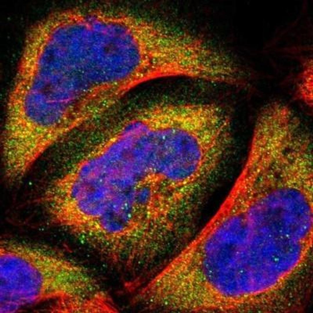 Immunocytochemistry/Immunofluorescence: FABP4/A-FABP Antibody [NBP1-89218] - Staining of human cell line A-431 shows positivity in cytoplasm.