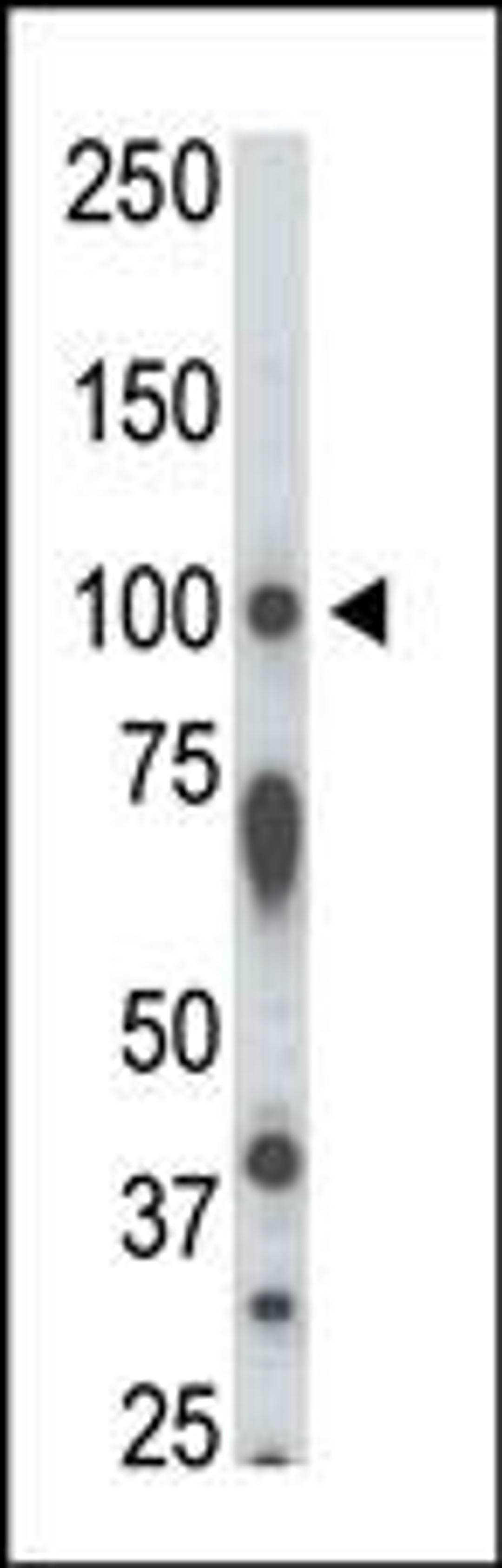 Antibody is used in Western blot to detect STK31 in rat testis tissue lysate.