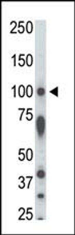 Antibody is used in Western blot to detect STK31 in rat testis tissue lysate.