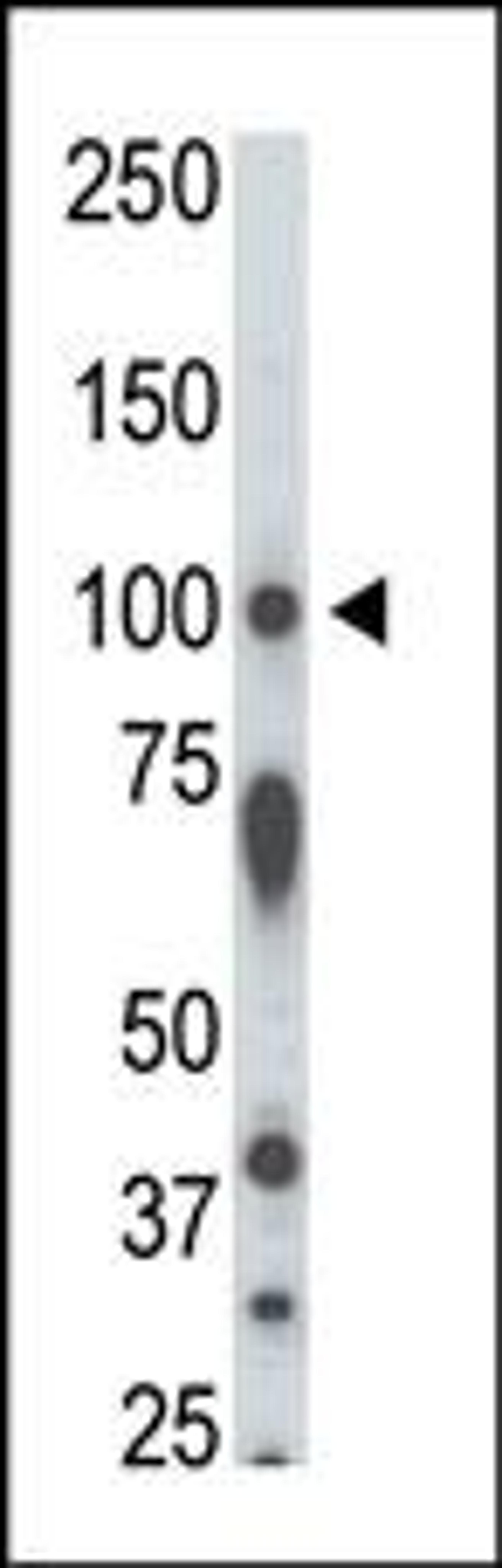 Antibody is used in Western blot to detect STK31 in rat testis tissue lysate.