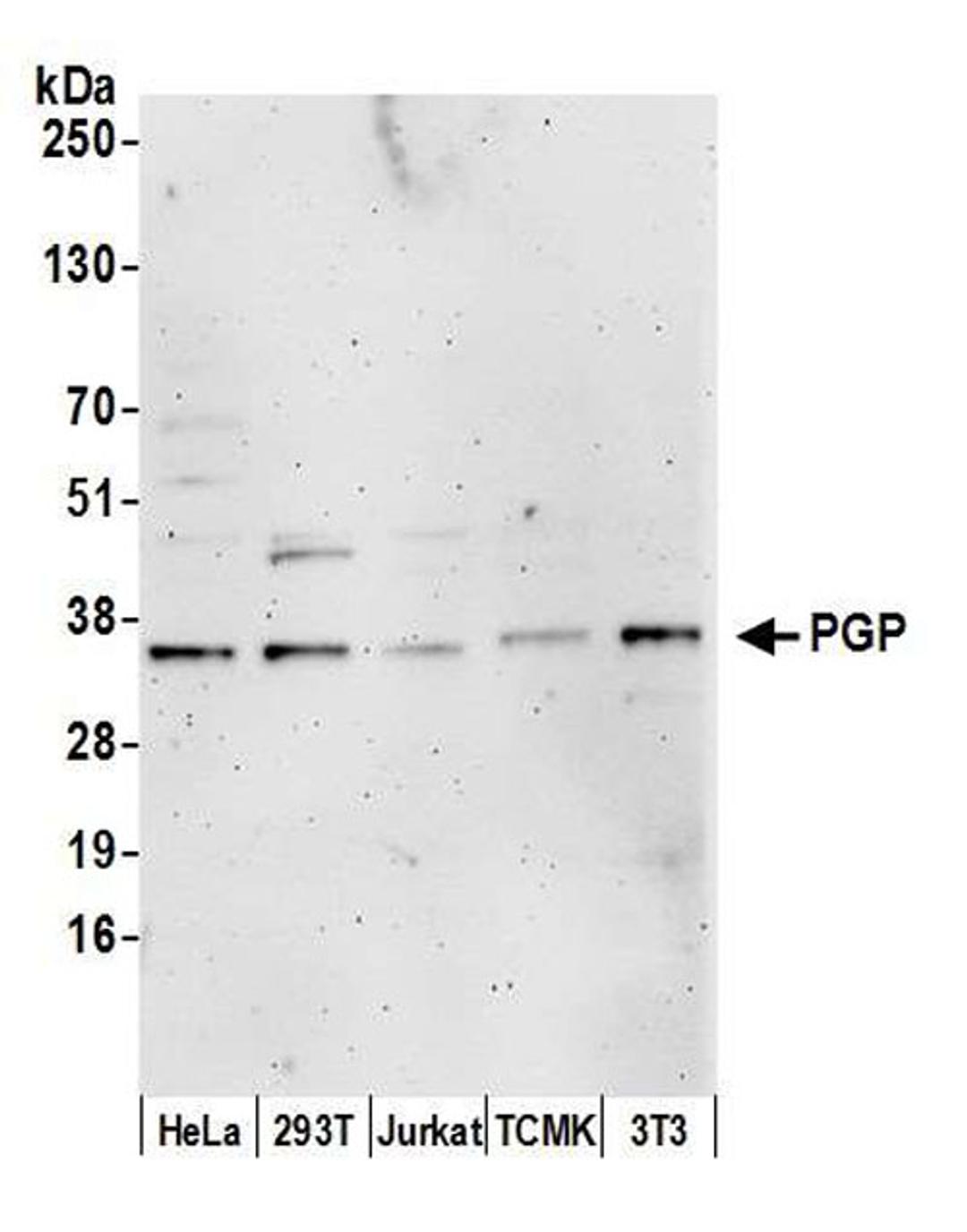 Detection of human and mouse PGP by WB.