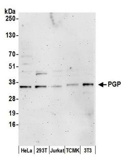 Detection of human and mouse PGP by WB.