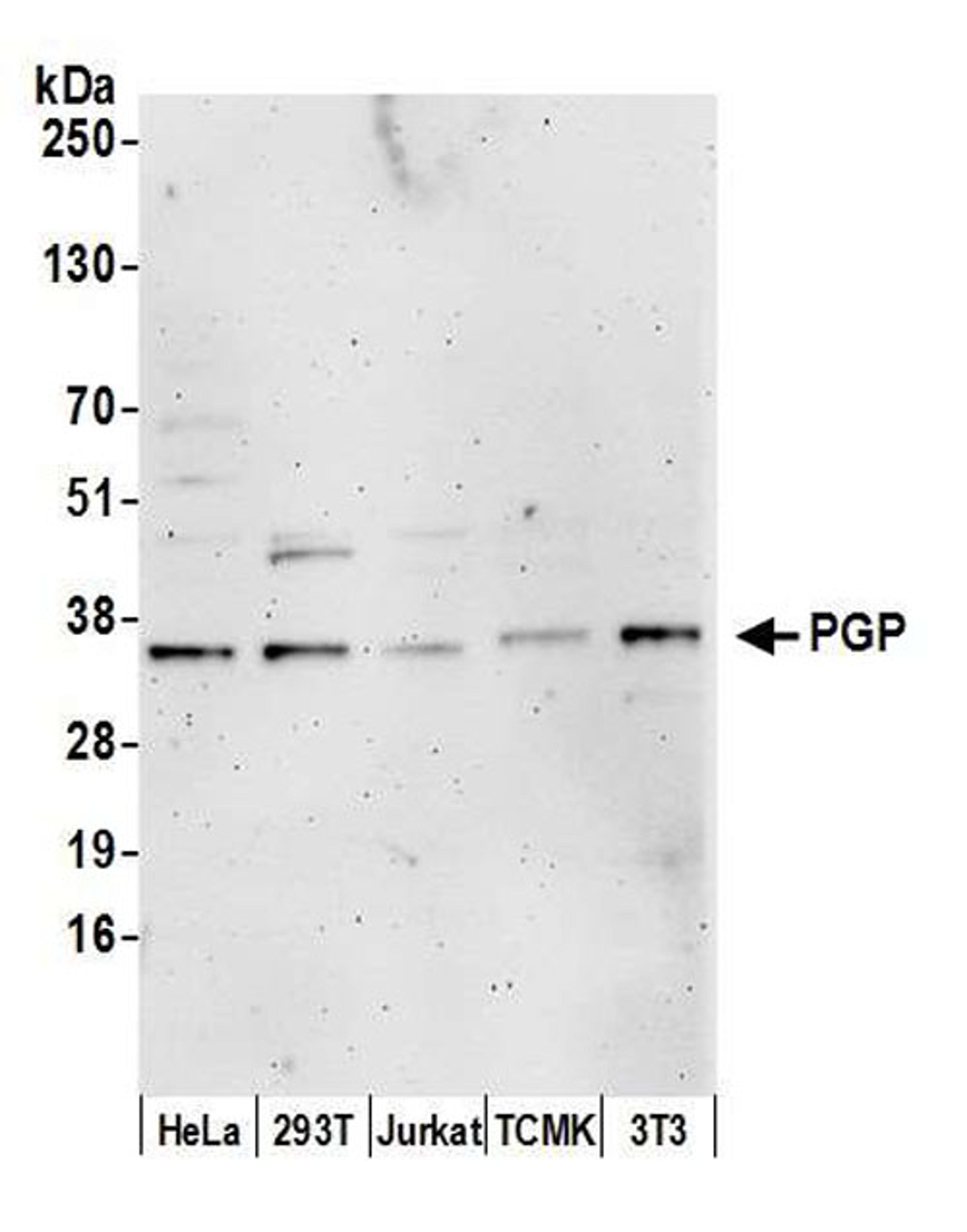 Detection of human and mouse PGP by WB.