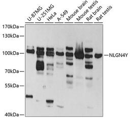 Western blot - NLGN4Y antibody (A4513)