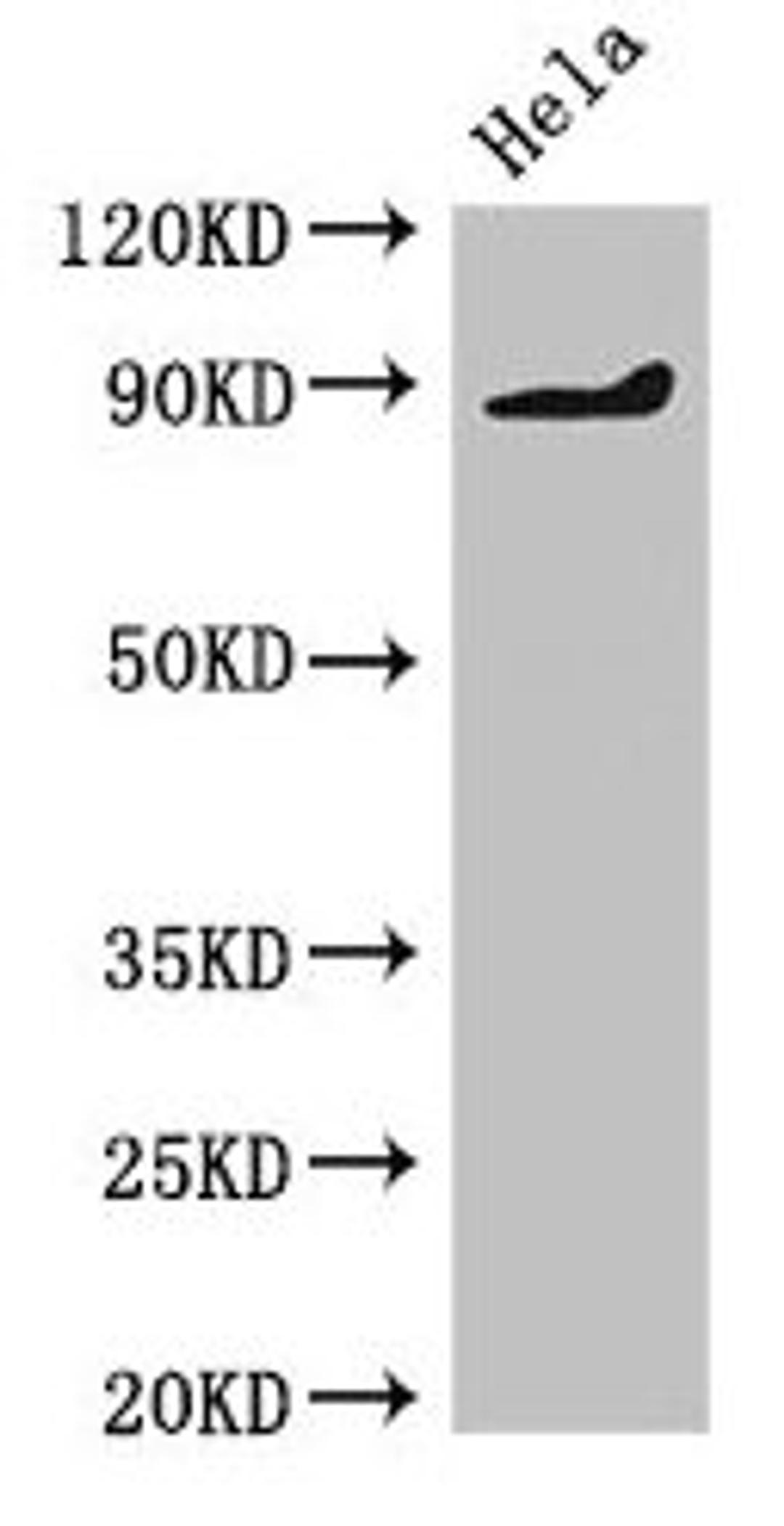 Western Blot. Positive WB detected in: Hela whole cell lysate. All lanes: PDE2A antibody at 2µg/ml. Secondary. Goat polyclonal to rabbit IgG at 1/50000 dilution. Predicted band size: 106, 104, 105, 79, 88 kDa. Observed band size: 88 kDa