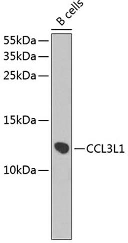 Western blot - CCL3L1 antibody (A2852)