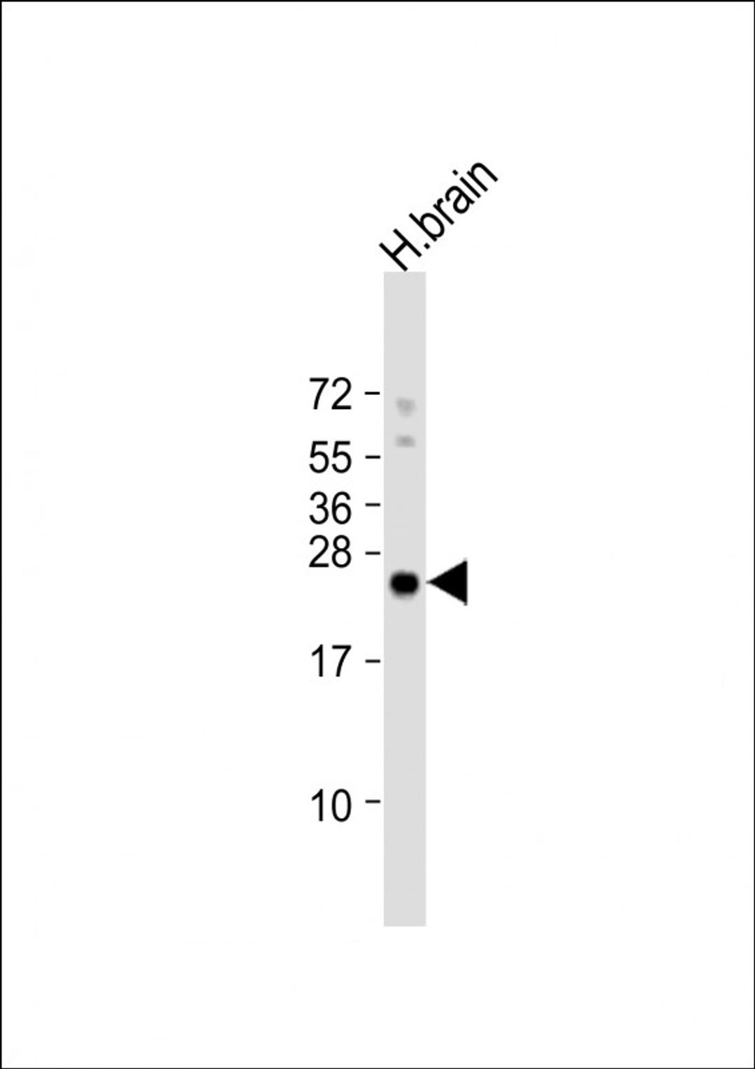 Western Blot at 1:4000 dilution + human brain lysate Lysates/proteins at 20 ug per lane.