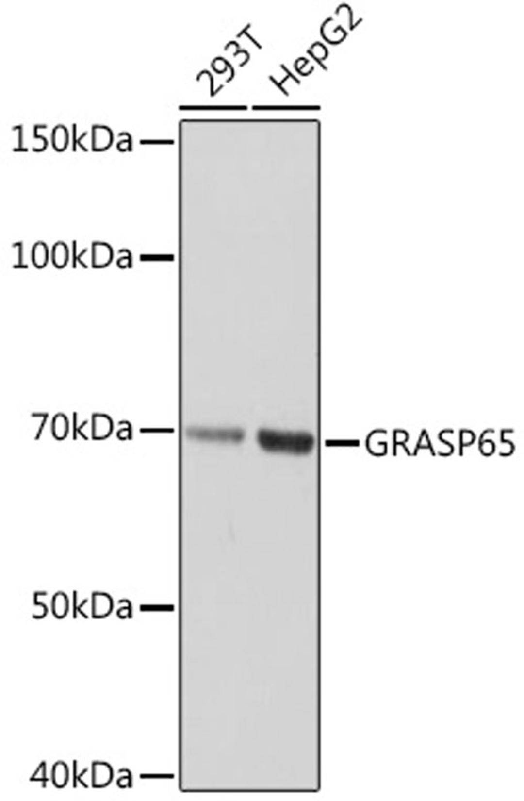 Western blot - GRASP65 Rabbit mAb (A2316)