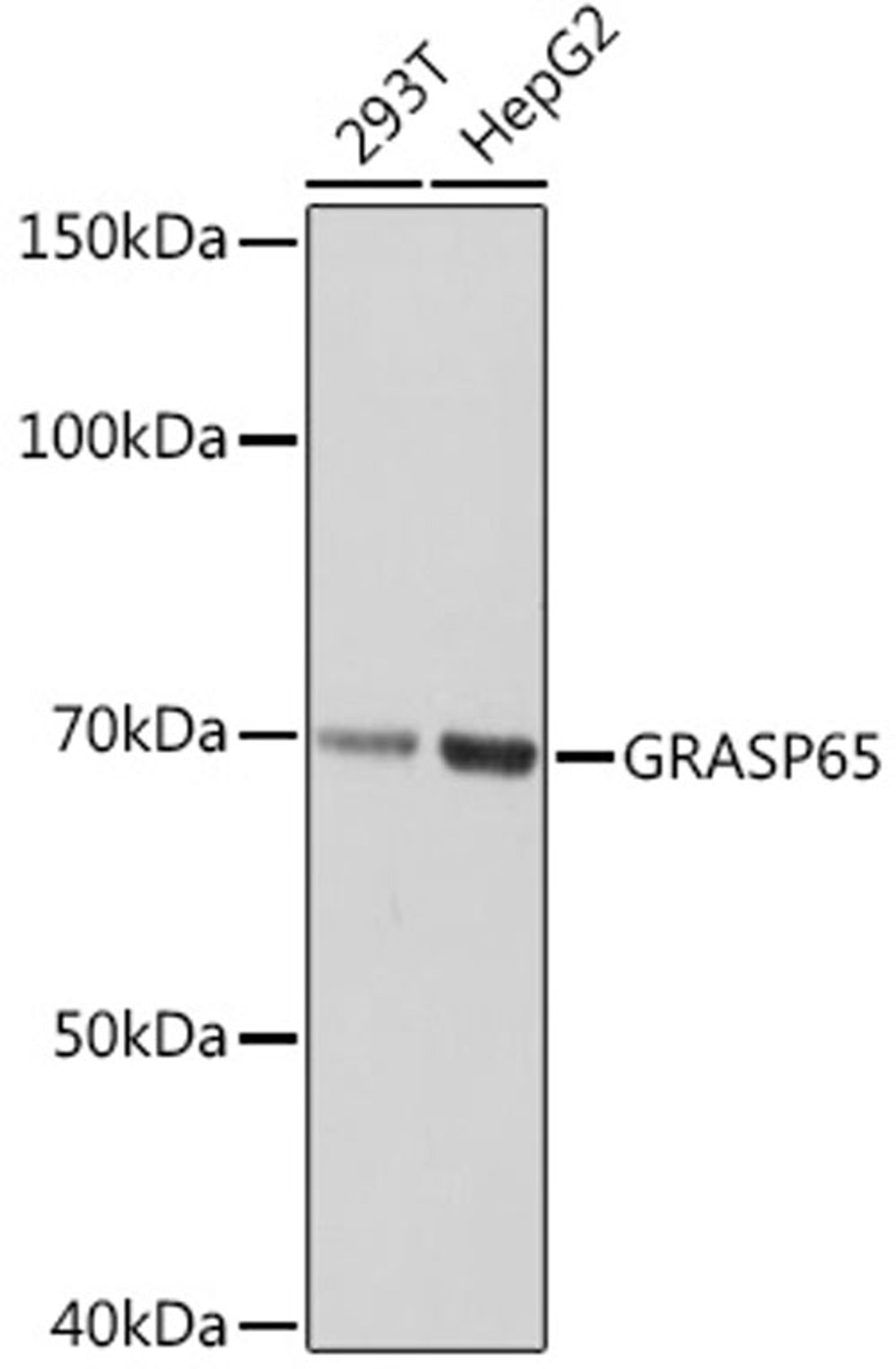 Western blot - GRASP65 Rabbit mAb (A2316)