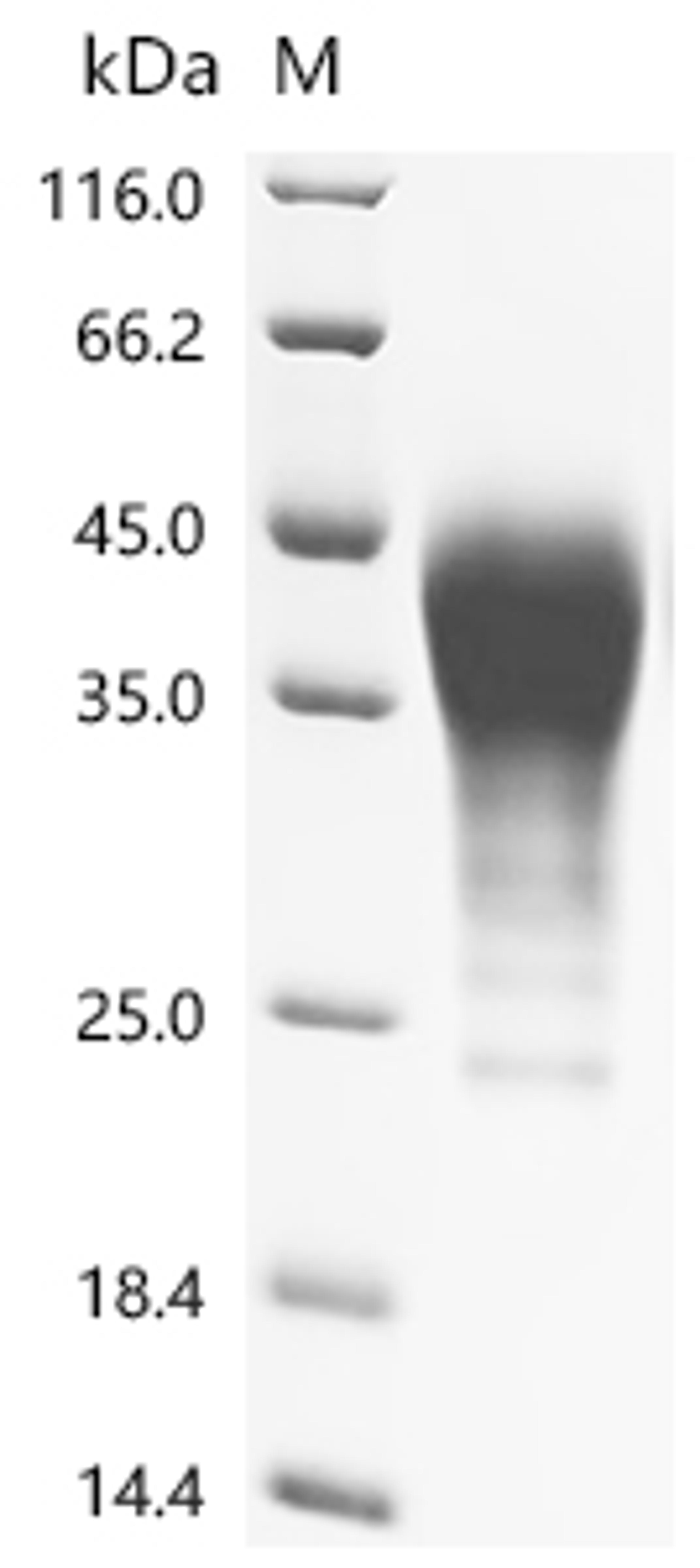 (Tris-Glycine gel) Discontinuous SDS-PAGE (reduced) with 5% enrichment gel and 15% separation gel.