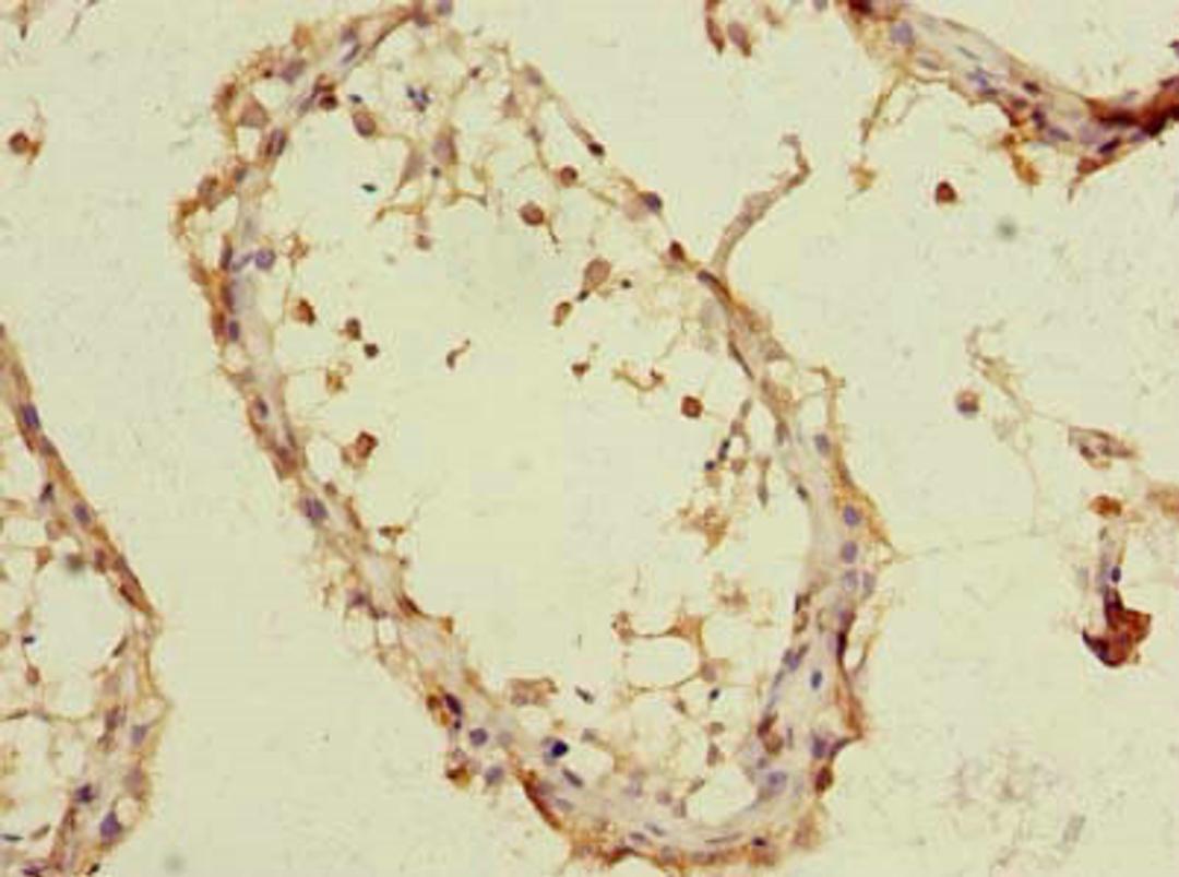 Immunohistochemistry of paraffin-embedded human testis tissue using CSB-PA023898LA01HU at dilution of 1:100