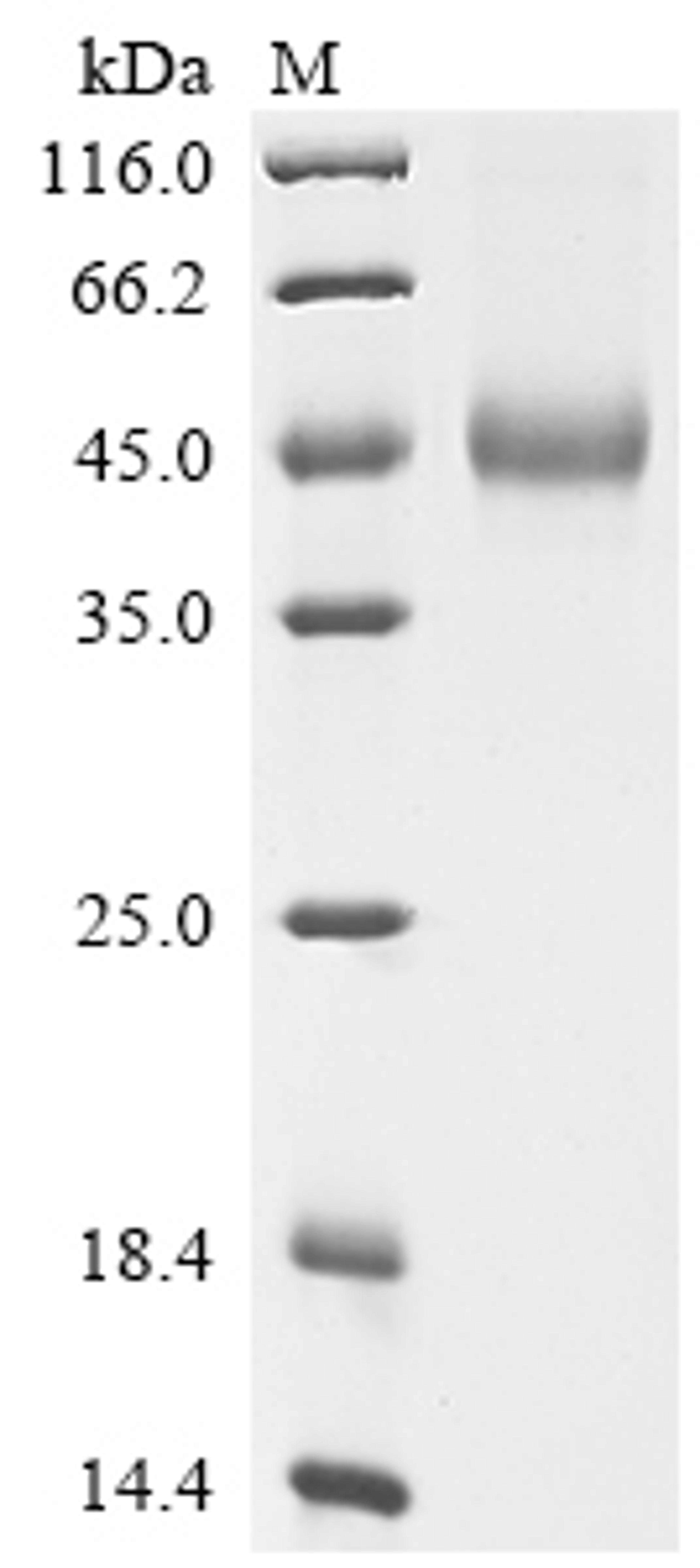 (Tris-Glycine gel) Discontinuous SDS-PAGE (reduced) with 5% enrichment gel and 15% separation gel.