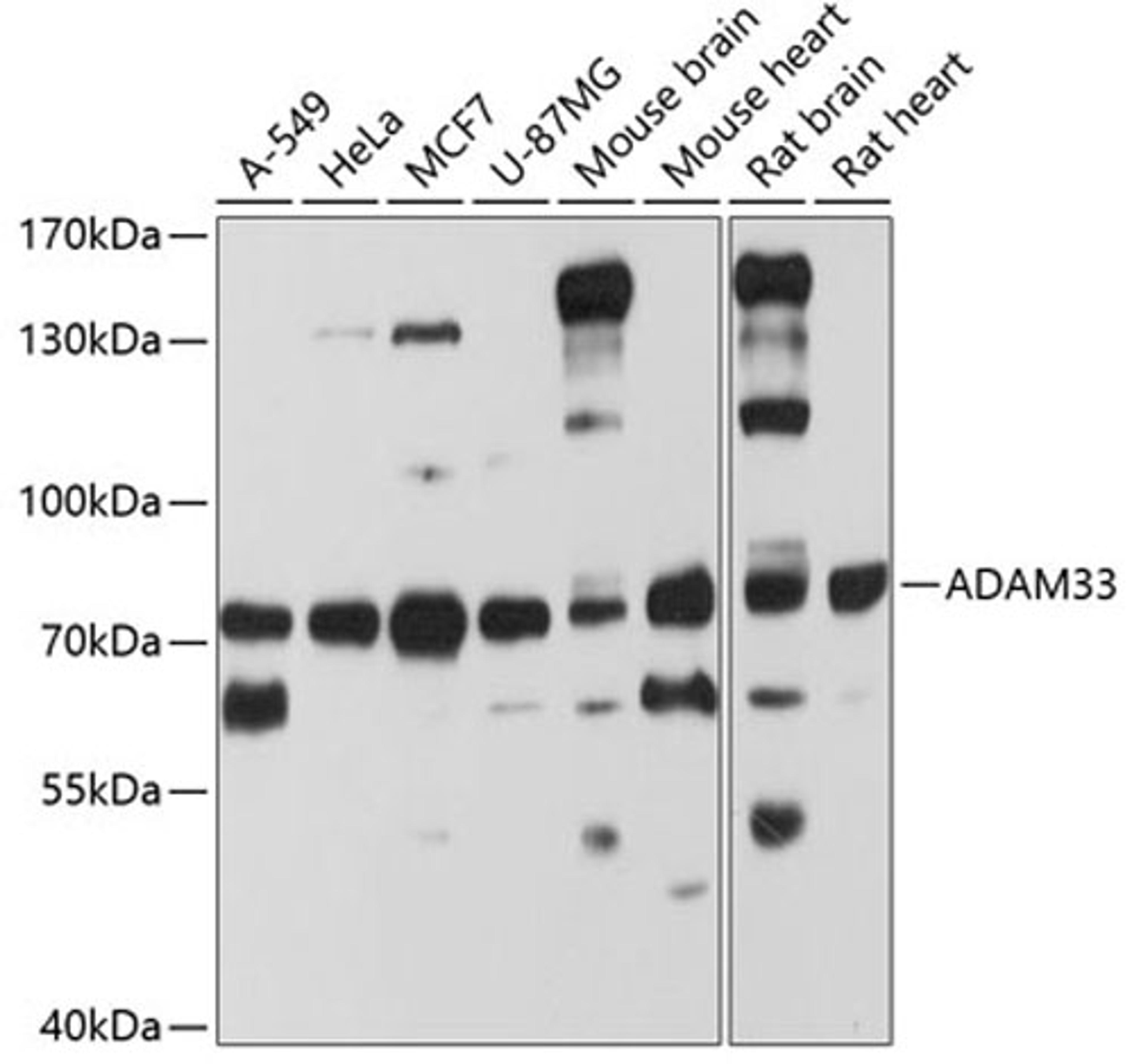 Western blot - ADAM33 antibody (A8265)