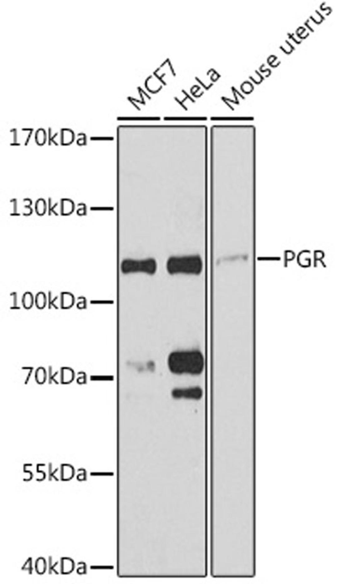 Western blot - PGR antibody (A0321)