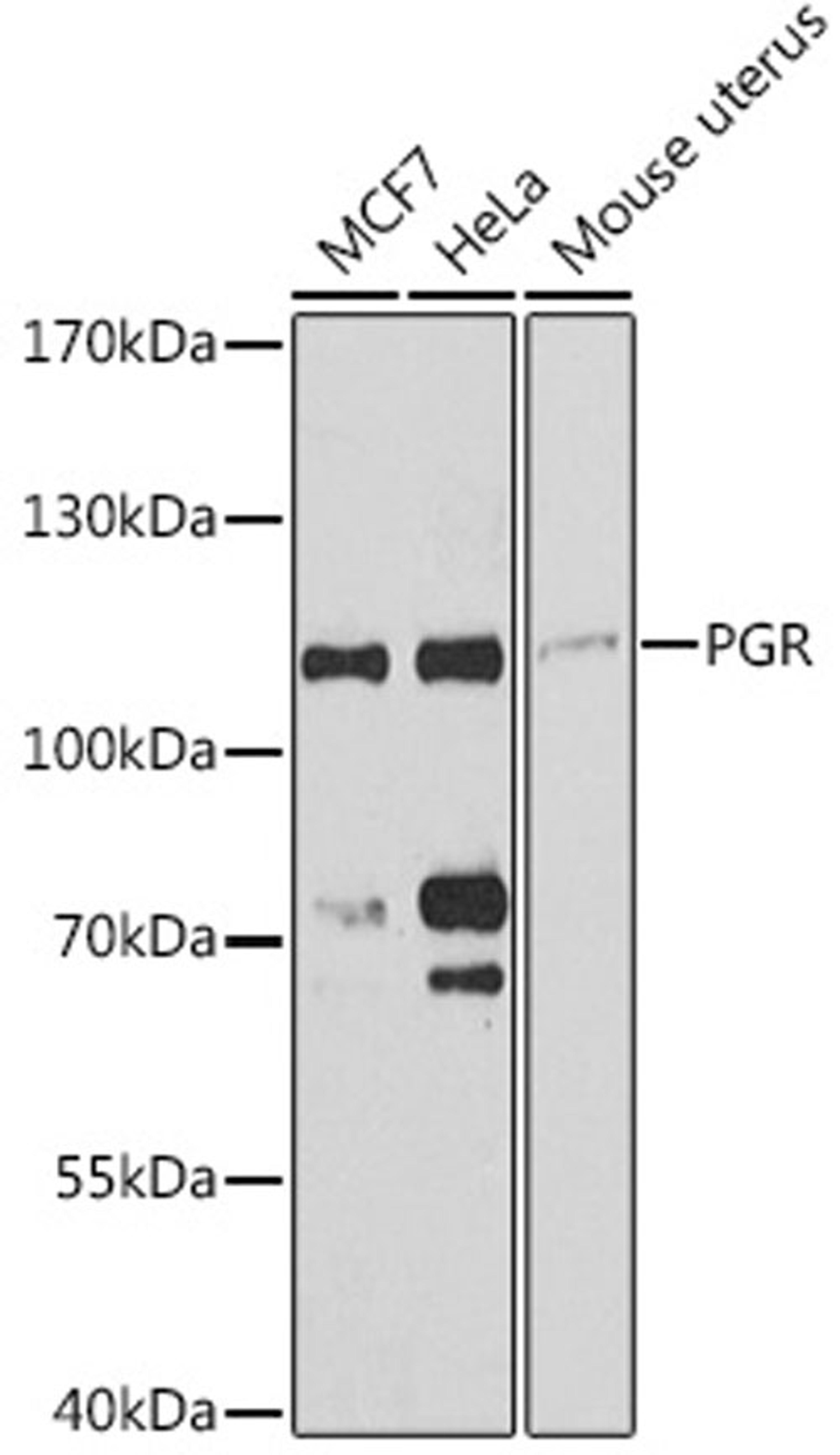 Western blot - PGR antibody (A0321)