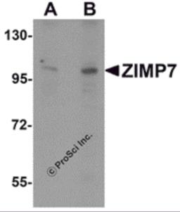 Western blot analysis of ZIMP7 in A20 cell lysate with ZIMP7 antibody at (A) 0.25 μg/ml and (B) 0.5 μg/mL.