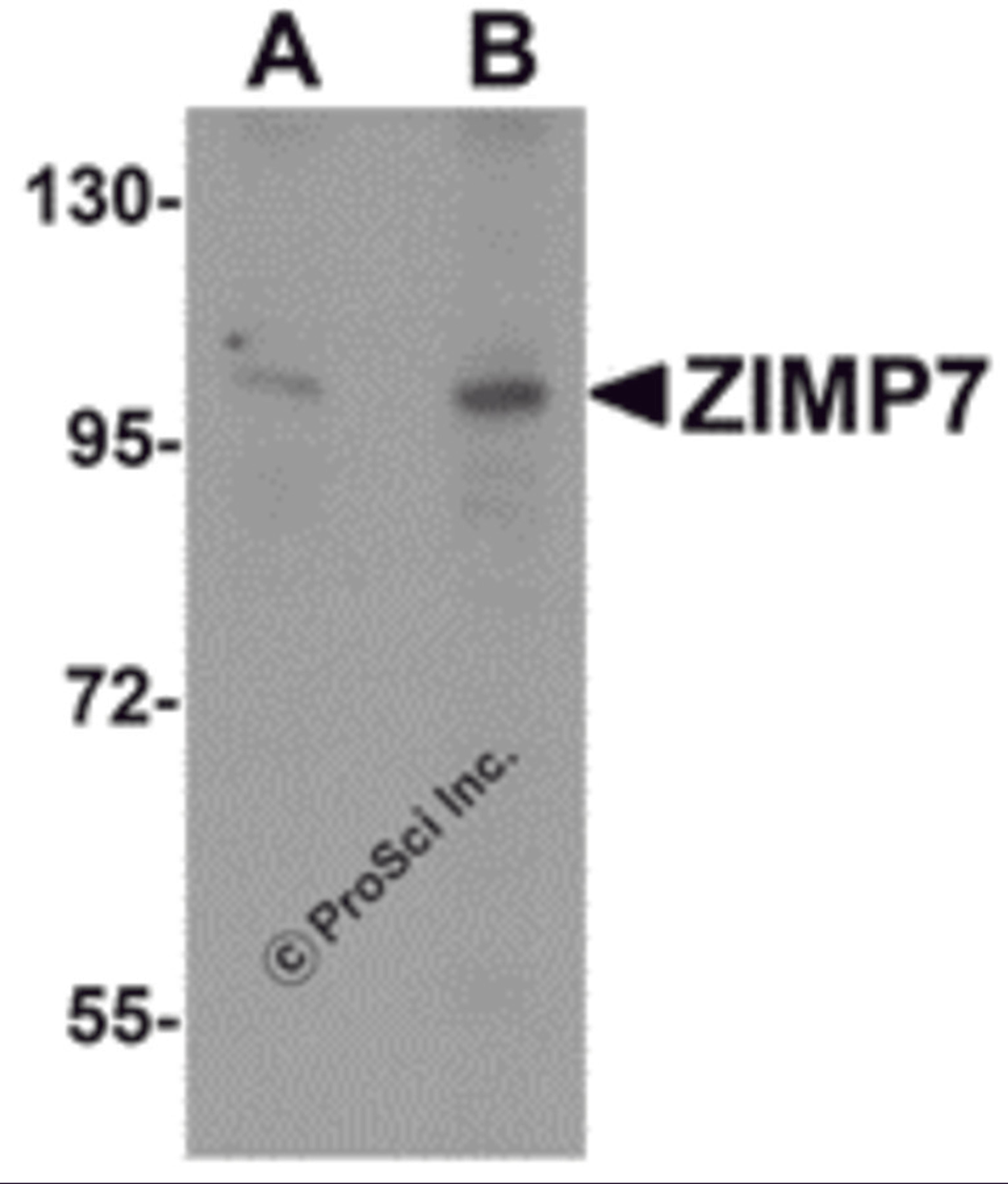 Western blot analysis of ZIMP7 in A20 cell lysate with ZIMP7 antibody at (A) 0.25 μg/ml and (B) 0.5 μg/mL.
