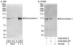 Detection of human Exonuclease 1 by western blot and immunoprecipitation.