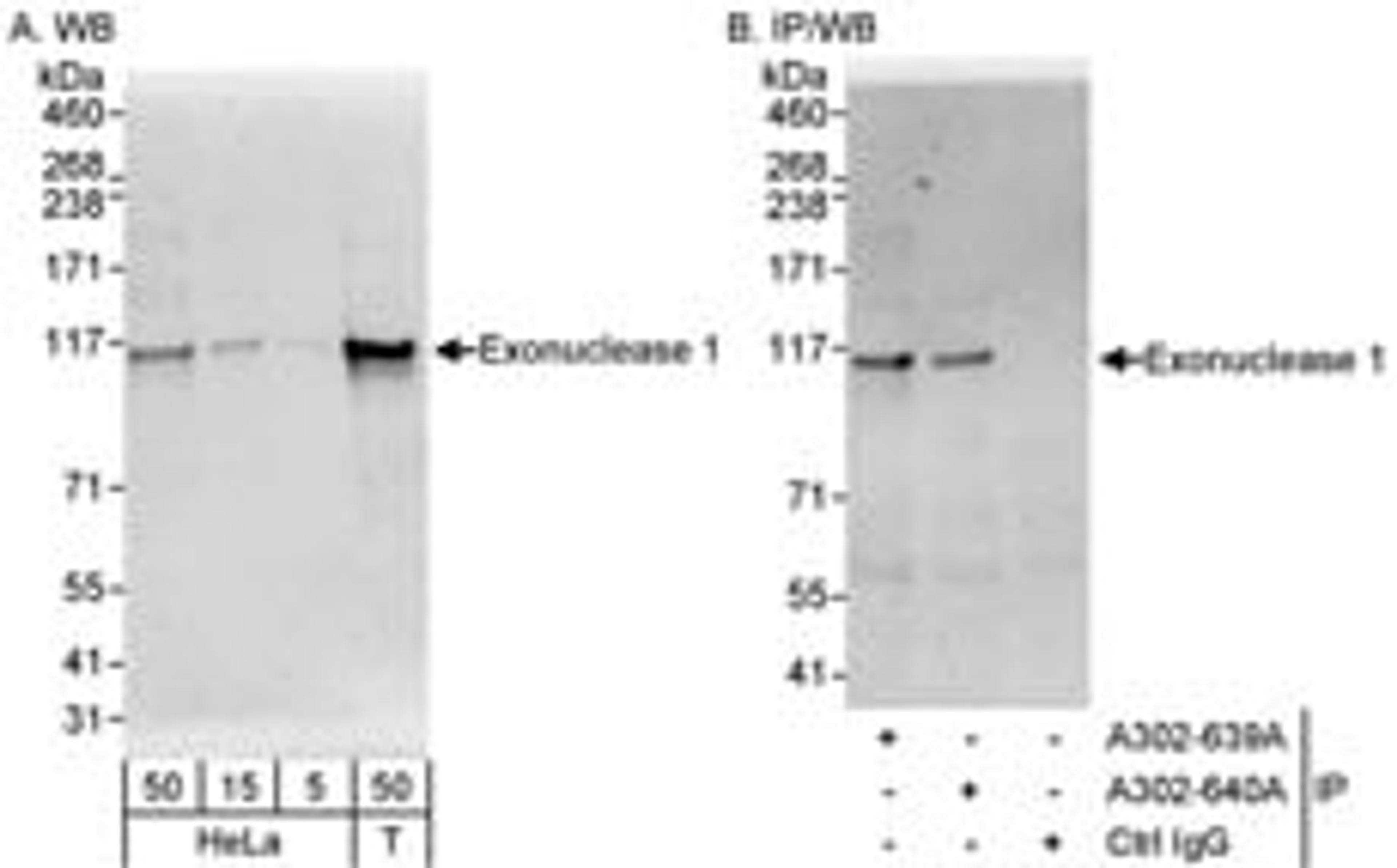 Detection of human Exonuclease 1 by western blot and immunoprecipitation.