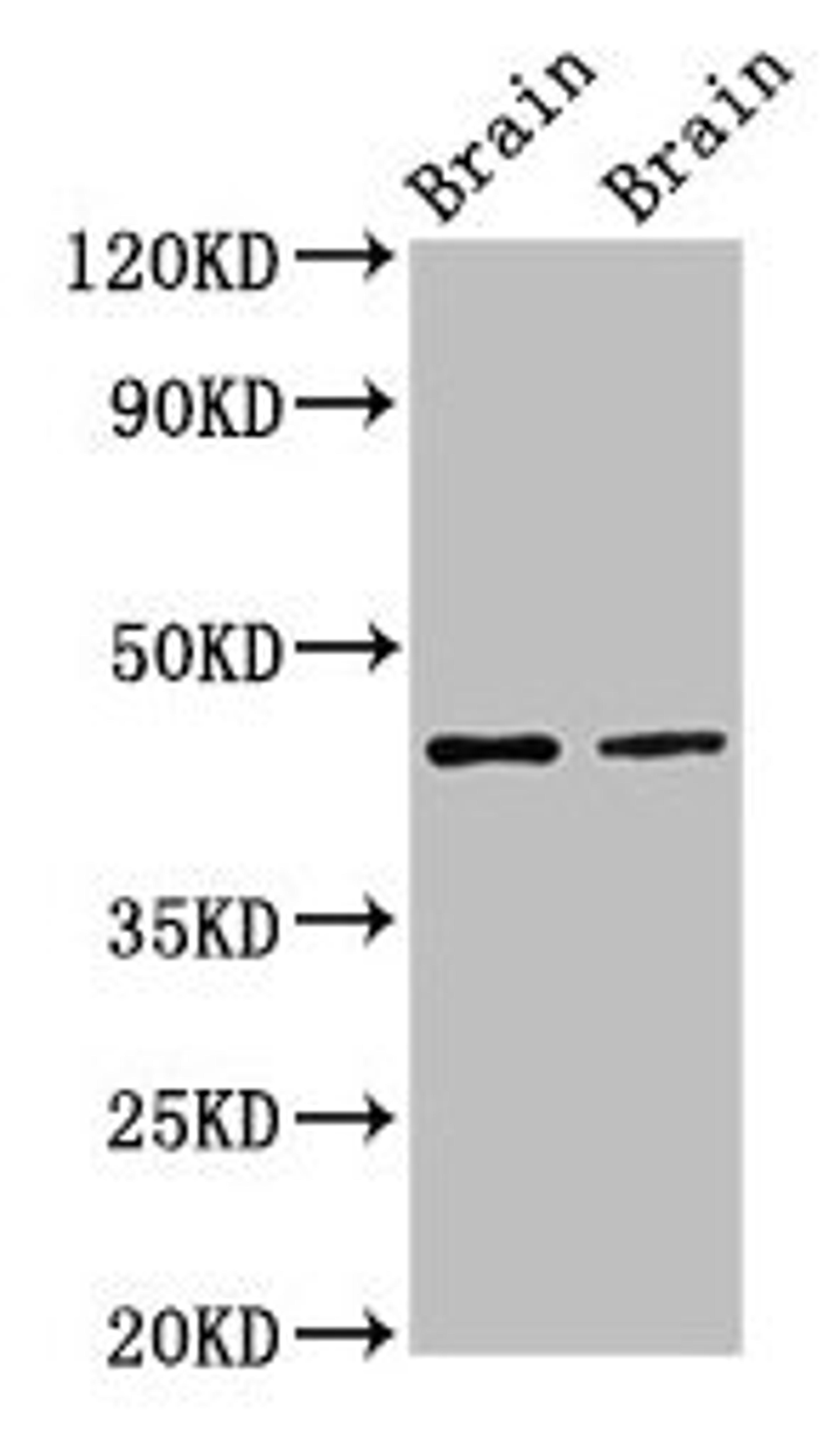 Western Blot. Positive WB detected in: Rat brain tissue, Mouse brain tissue. All lanes: MAPK3 antibody at 3µg/ml. Secondary. Goat polyclonal to rabbit IgG at 1/50000 dilution. Predicted band size: 44, 39, 41 kDa. Observed band size: 44 kDa