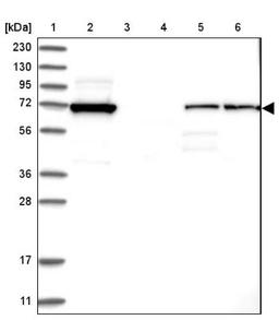 Western Blot: KAT8 regulatory NSL3 Antibody [NBP1-83875] - Lane 1: Marker [kDa] 230, 130, 95, 72, 56, 36, 28, 17, 11<br/>Lane 2: Human cell line RT-4<br/>Lane 3: Human cell line U-251MG sp<br/>Lane 4: Human plasma (IgG/HSA depleted)<br/>Lane 5: Human liver tissue<br/>Lane 6: Human tonsil tissue