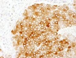 Detection of human HPIP/PBXIP1 by immunohistochemistry.