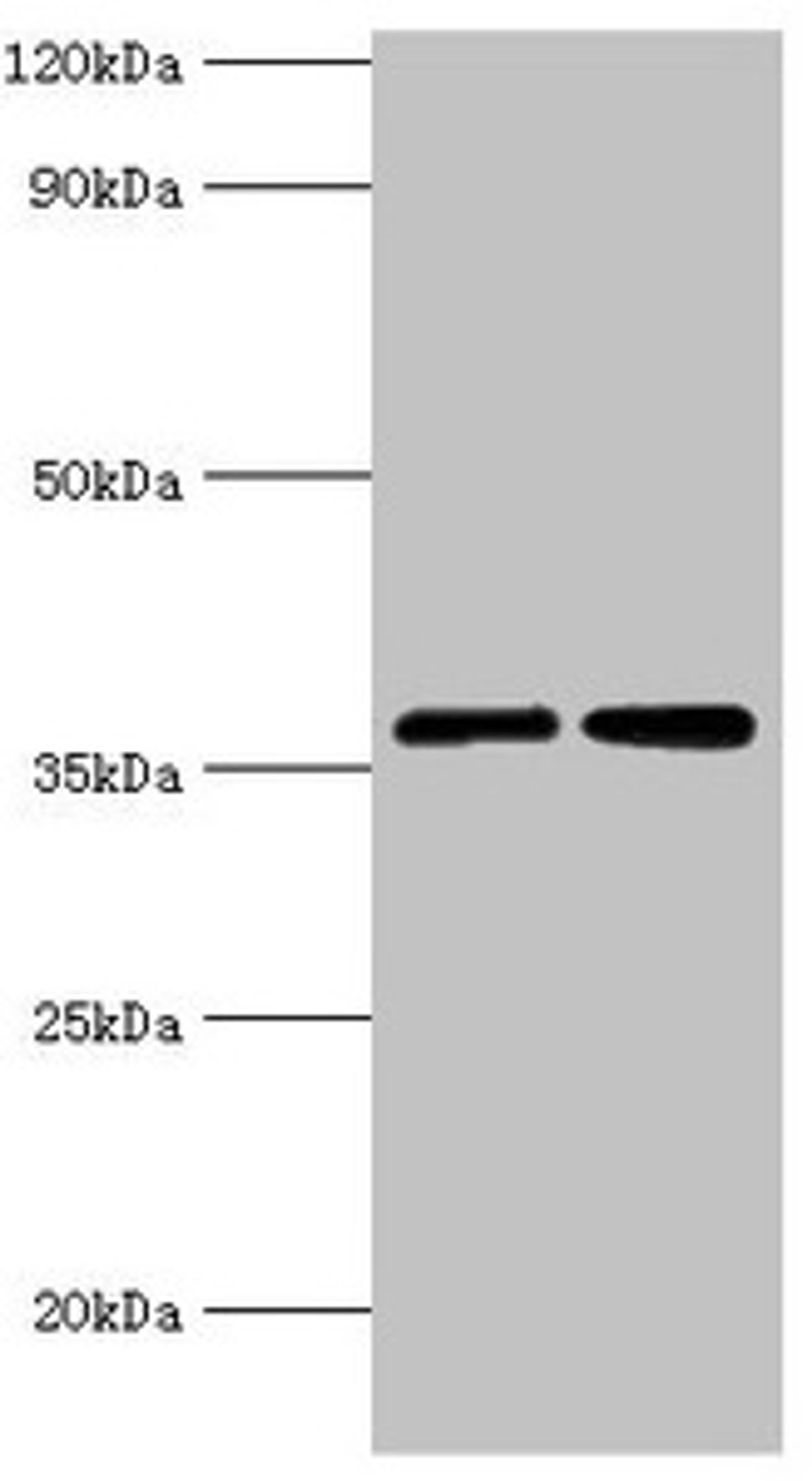 Western blot. All lanes: MDH2 antibody at 3µg/ml. Lane 1: 293T whole cell lysate. Lane 2: K562 whole cell lysate. Secondary. Goat polyclonal to rabbit IgG at 1/10000 dilution. Predicted band size: 36, 31 kDa. Observed band size: 36 kDa