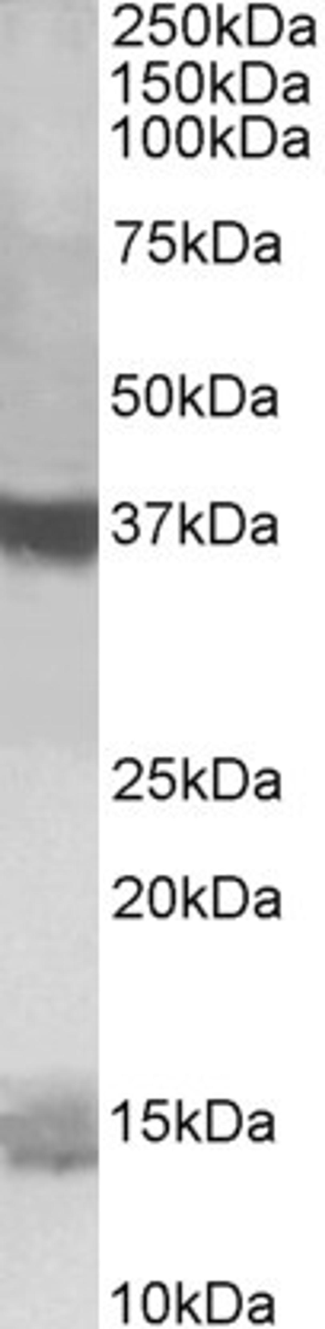 46-220 (1ug/ml) staining of K562 lysate (35ug protein in RIPA buffer). Primary incubation was 1 hour. Detected by chemiluminescence.