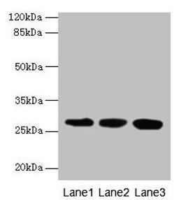 Western blot. All lanes: KHDC1 antibody at 5µg/ml. Lane 1: Mouse liver tissue. Lane 2: Mouse kidney tissue. Lane 3: Mouse gonadal tissue. Secondary. Goat polyclonal to rabbit IgG at 1/10000 dilution. Predicted band size: 28, 19 kDa. Observed band size: 28 kDa