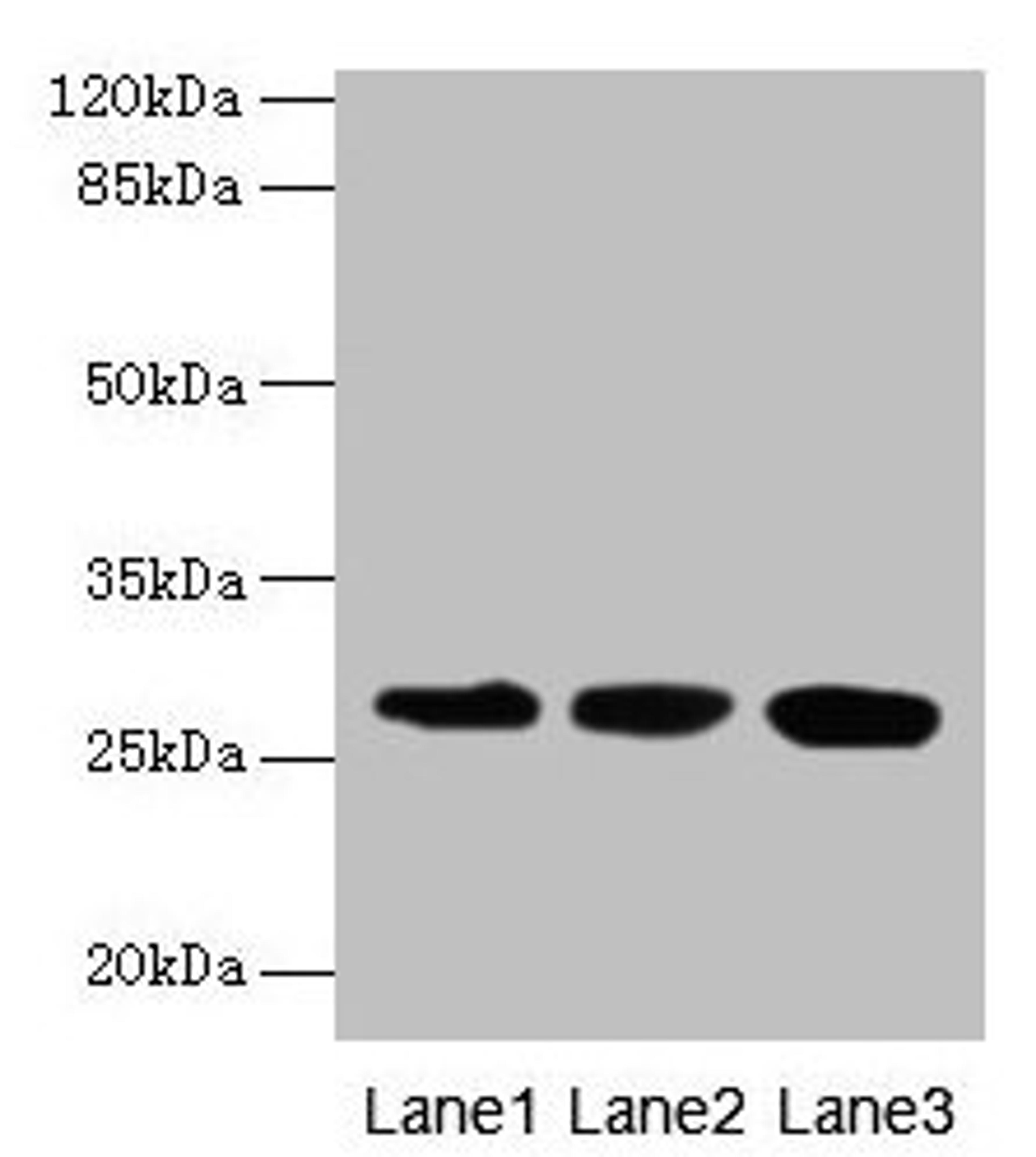 Western blot. All lanes: KHDC1 antibody at 5µg/ml. Lane 1: Mouse liver tissue. Lane 2: Mouse kidney tissue. Lane 3: Mouse gonadal tissue. Secondary. Goat polyclonal to rabbit IgG at 1/10000 dilution. Predicted band size: 28, 19 kDa. Observed band size: 28 kDa