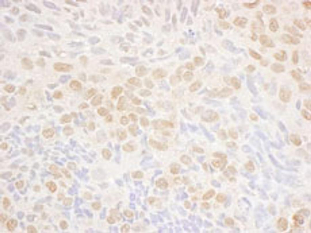 Detection of human DRAK1 by immunohistochemistry.