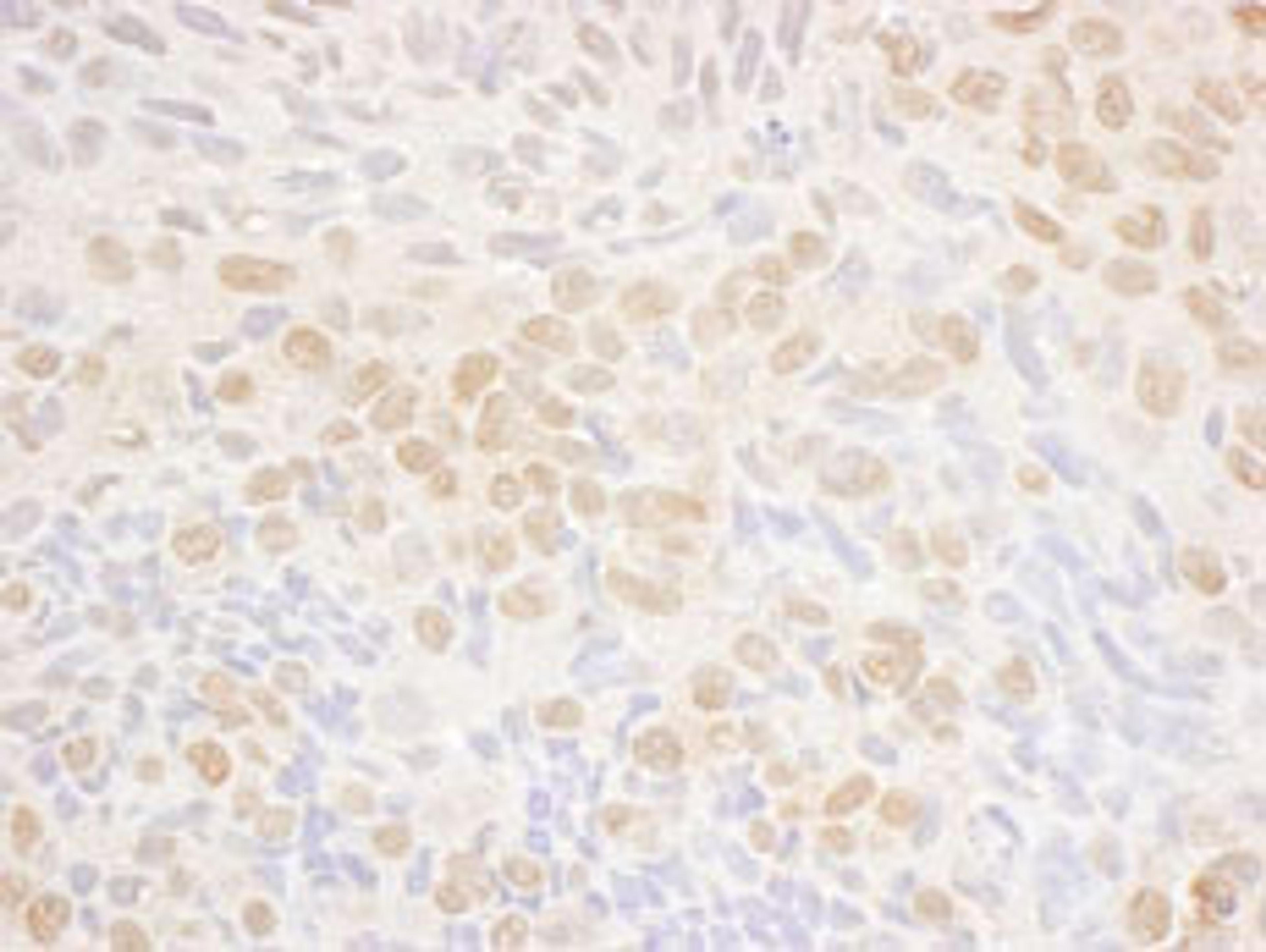 Detection of human DRAK1 by immunohistochemistry.