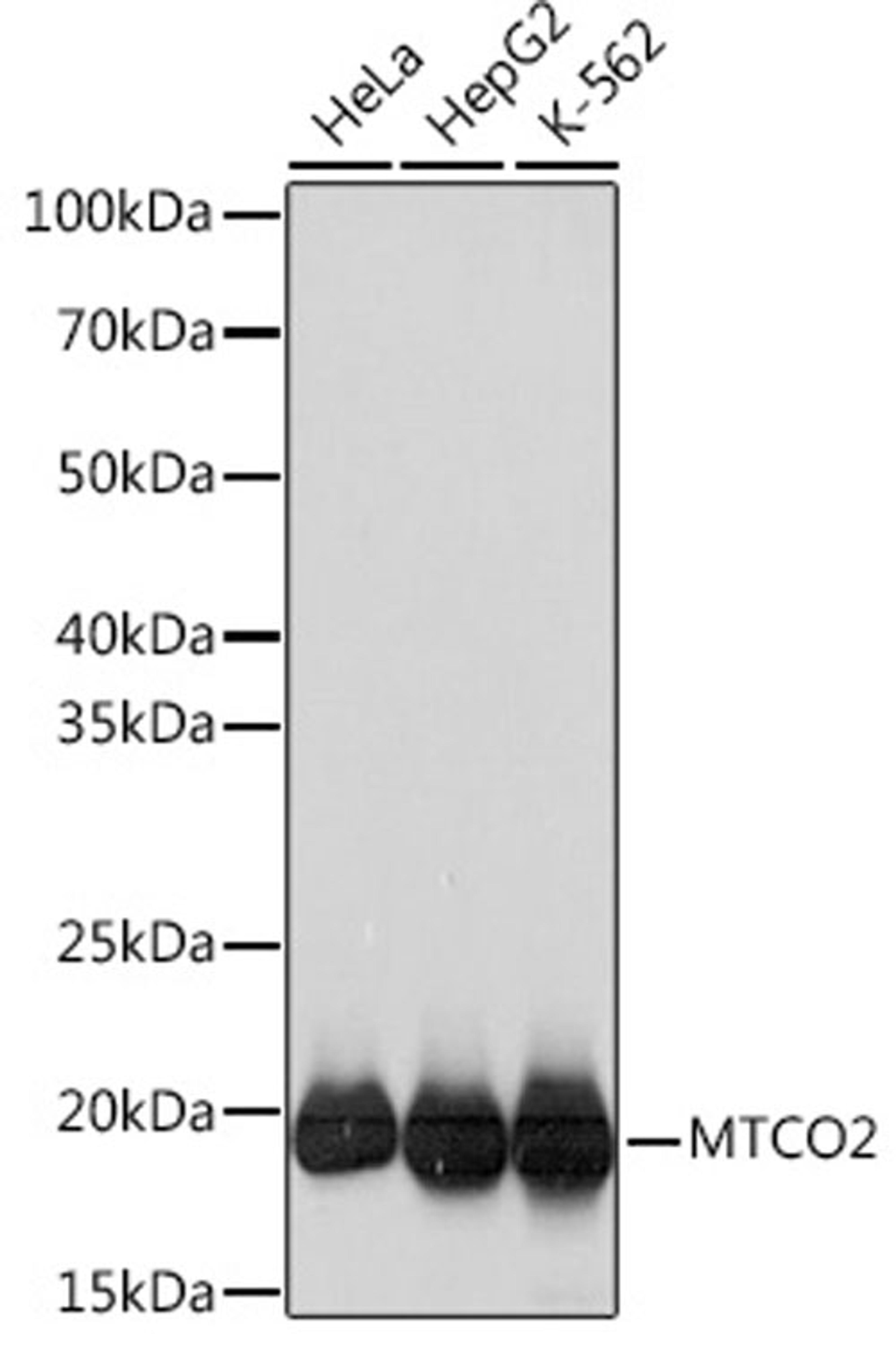 Western blot - MTCO2 Rabbit mAb (A3843)