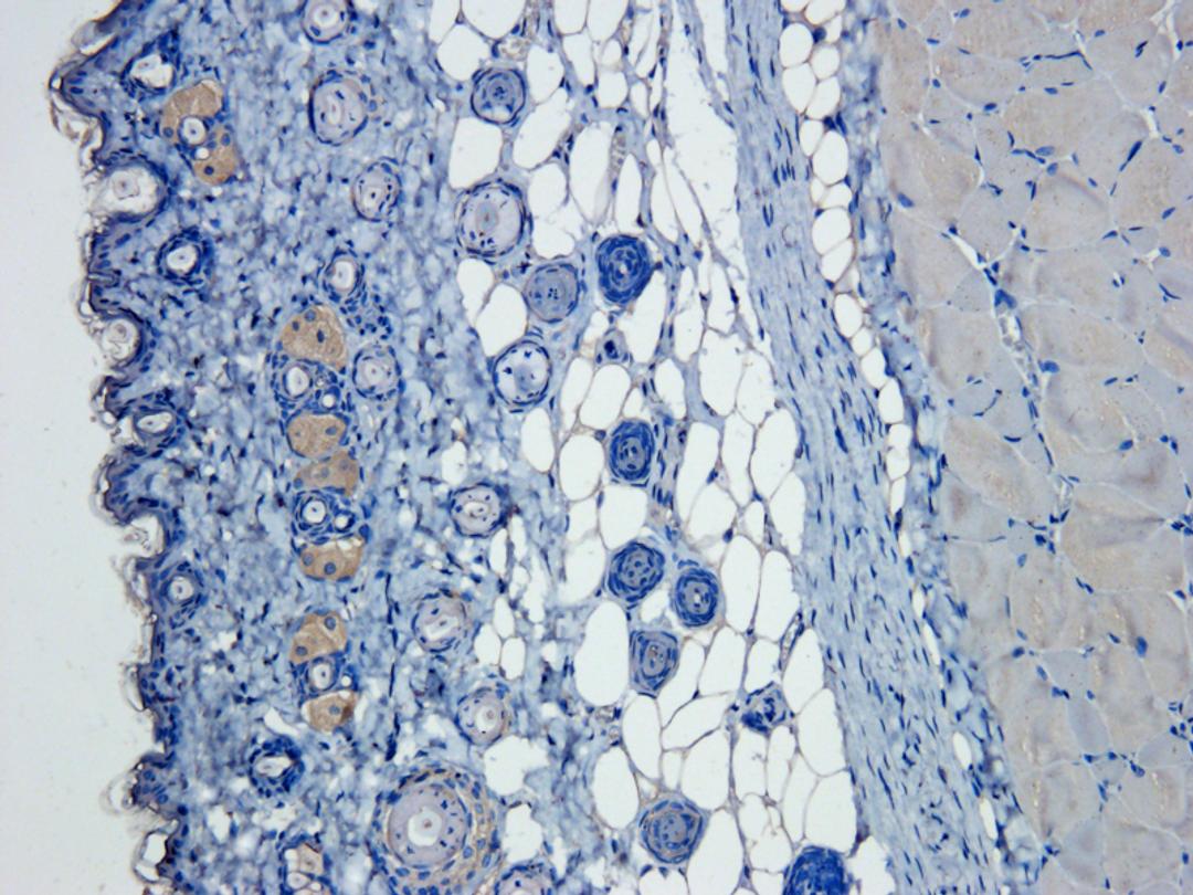 Immunohistochemical staining of paraffin embedded mouse skin tissue using anti-VEGFA (primary antibody at 1:50)