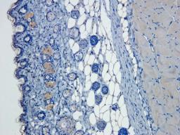 Immunohistochemical staining of paraffin embedded mouse skin tissue using anti-VEGFA (primary antibody at 1:50)